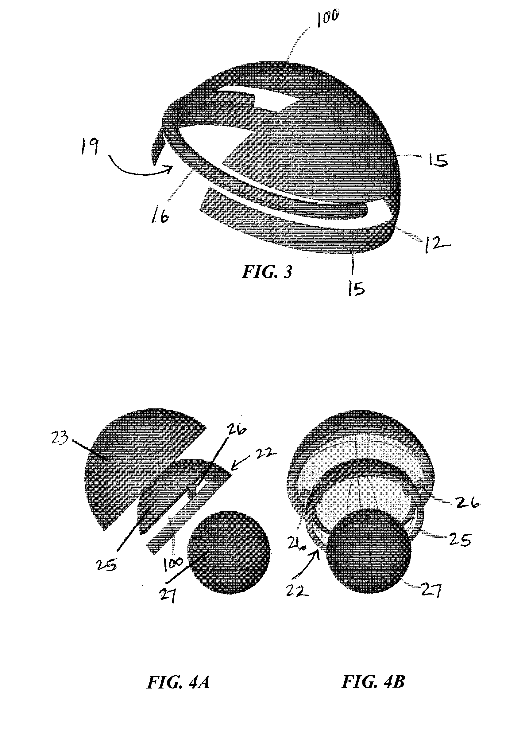 An artificial hip joint replacement system