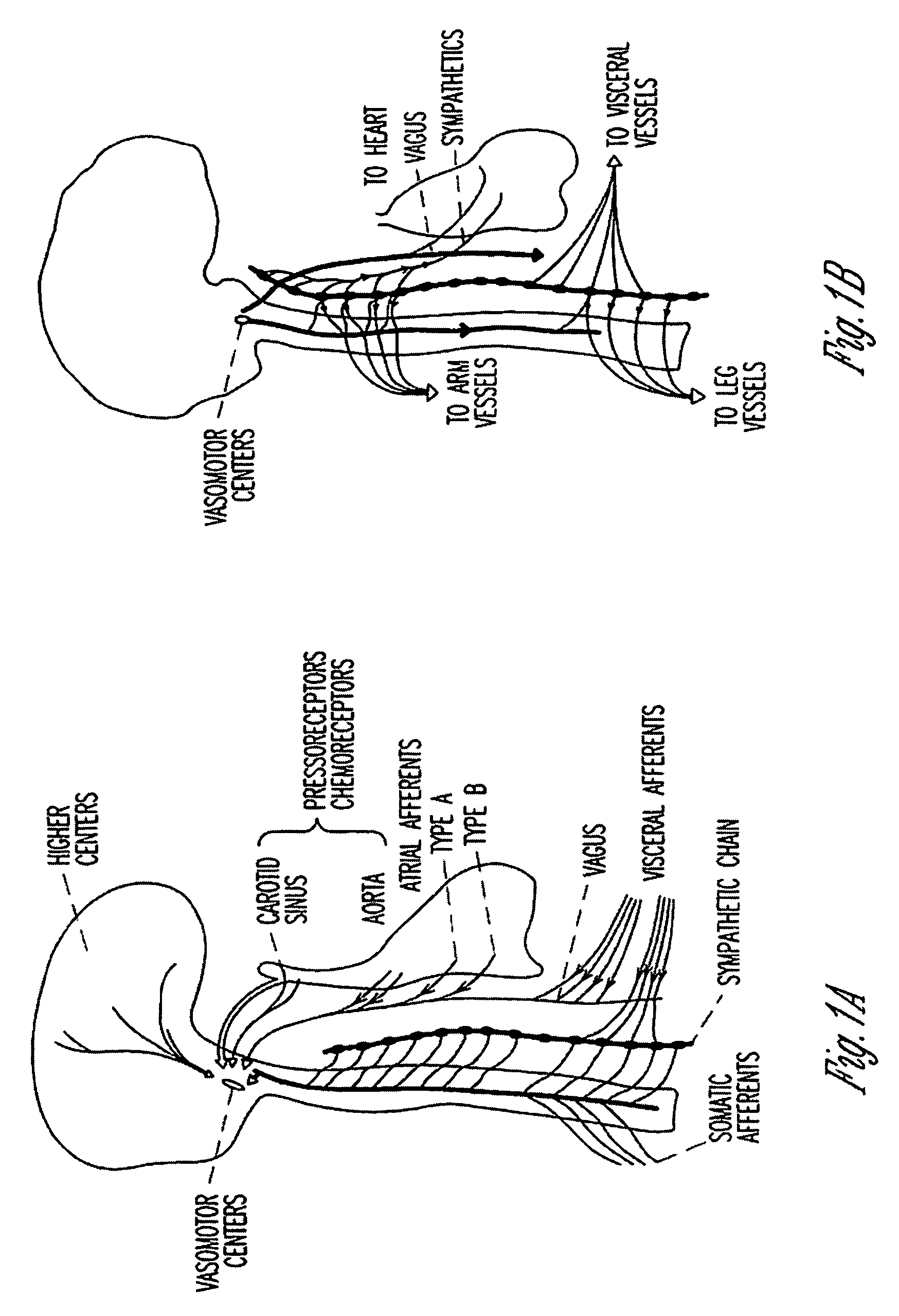 Coordinated therapy for disordered breathing including baroreflex modulation