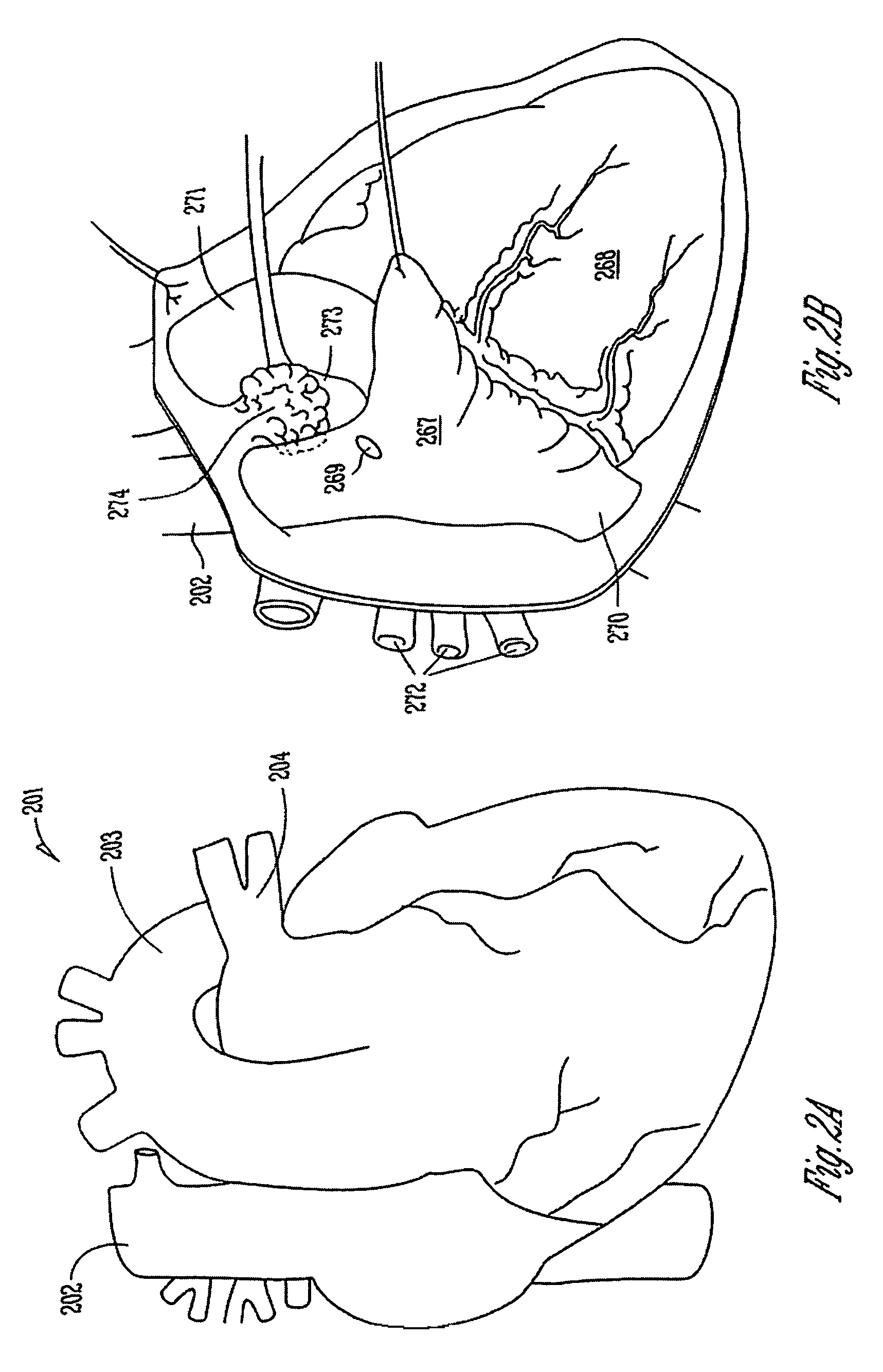 Coordinated therapy for disordered breathing including baroreflex modulation