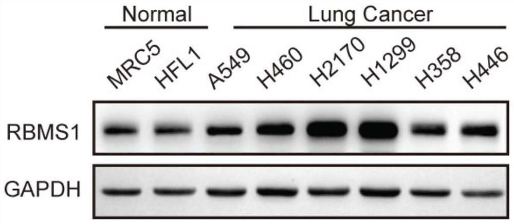 Application of reagent for down-regulating RBMS1 expression in preparation of medicine for treating lung cancer