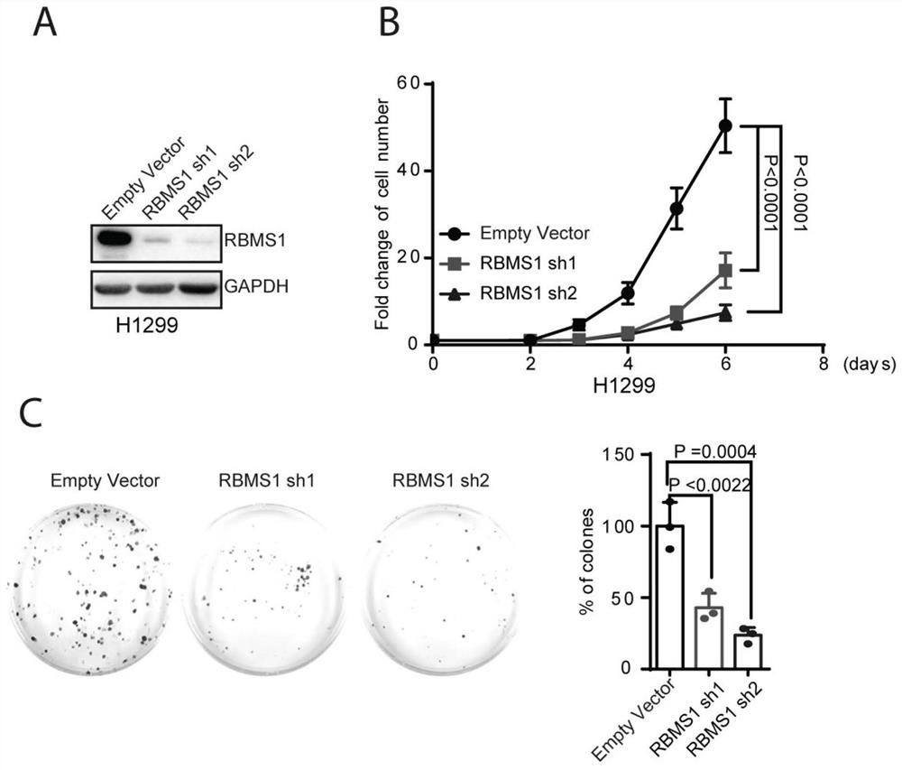 Application of reagent for down-regulating RBMS1 expression in preparation of medicine for treating lung cancer