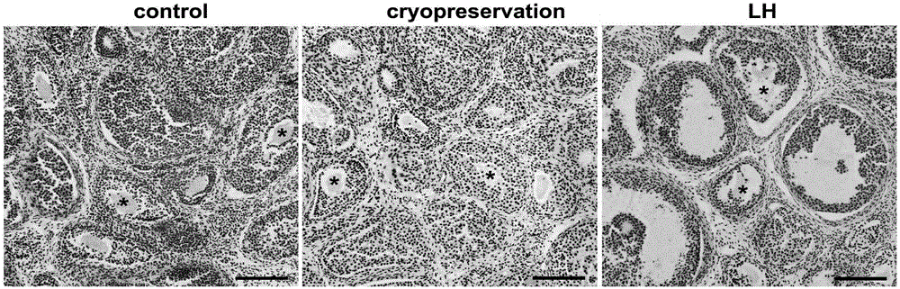 Ovary vitrification cryopreservation method under intervention of luteinizing hormone