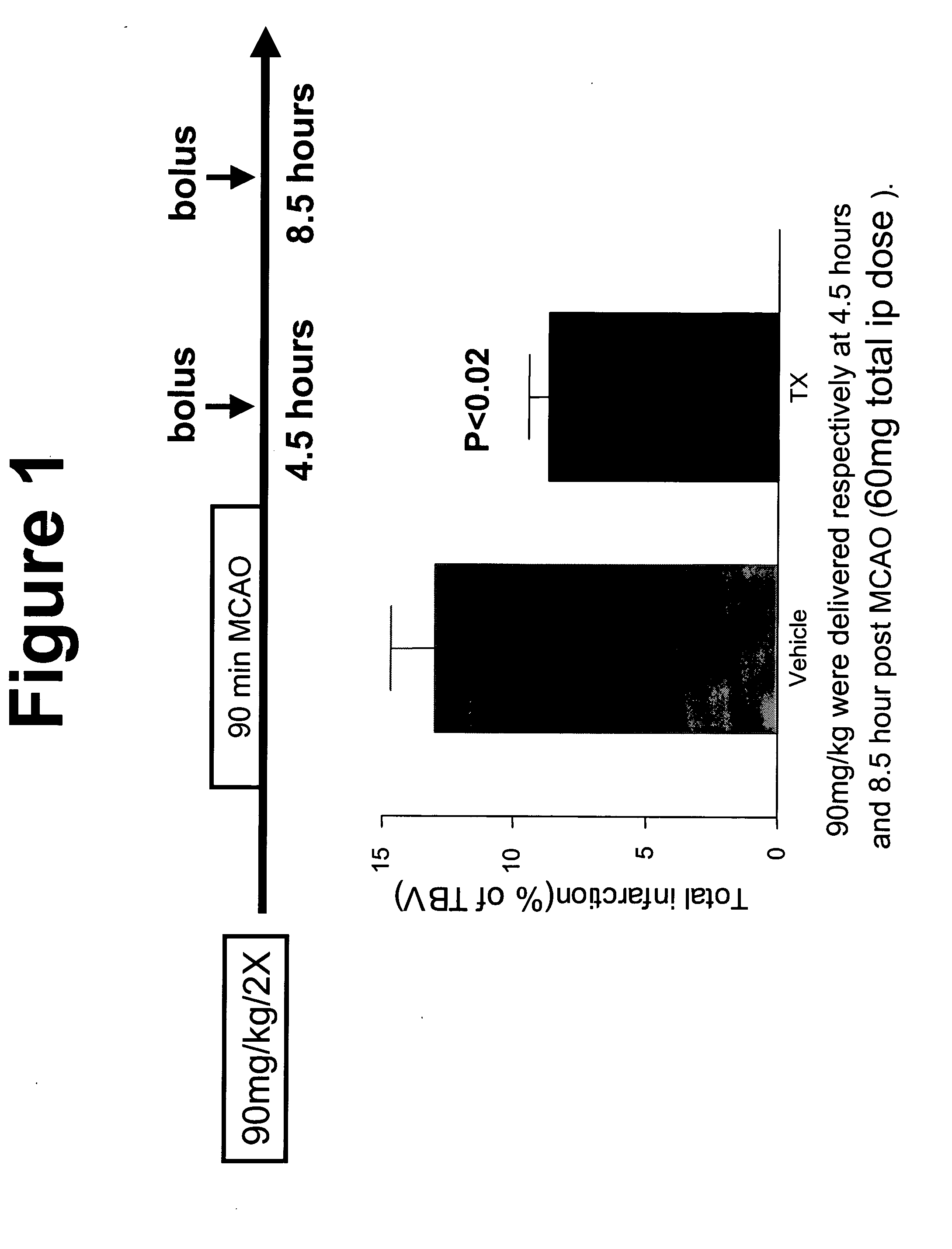 Treatment of neurologic disorders with inhibitors of 11beta-HSD1