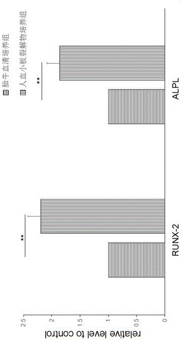 Preparation method for preparing culture kit of umbilical cord blood mesenchemal stem cells