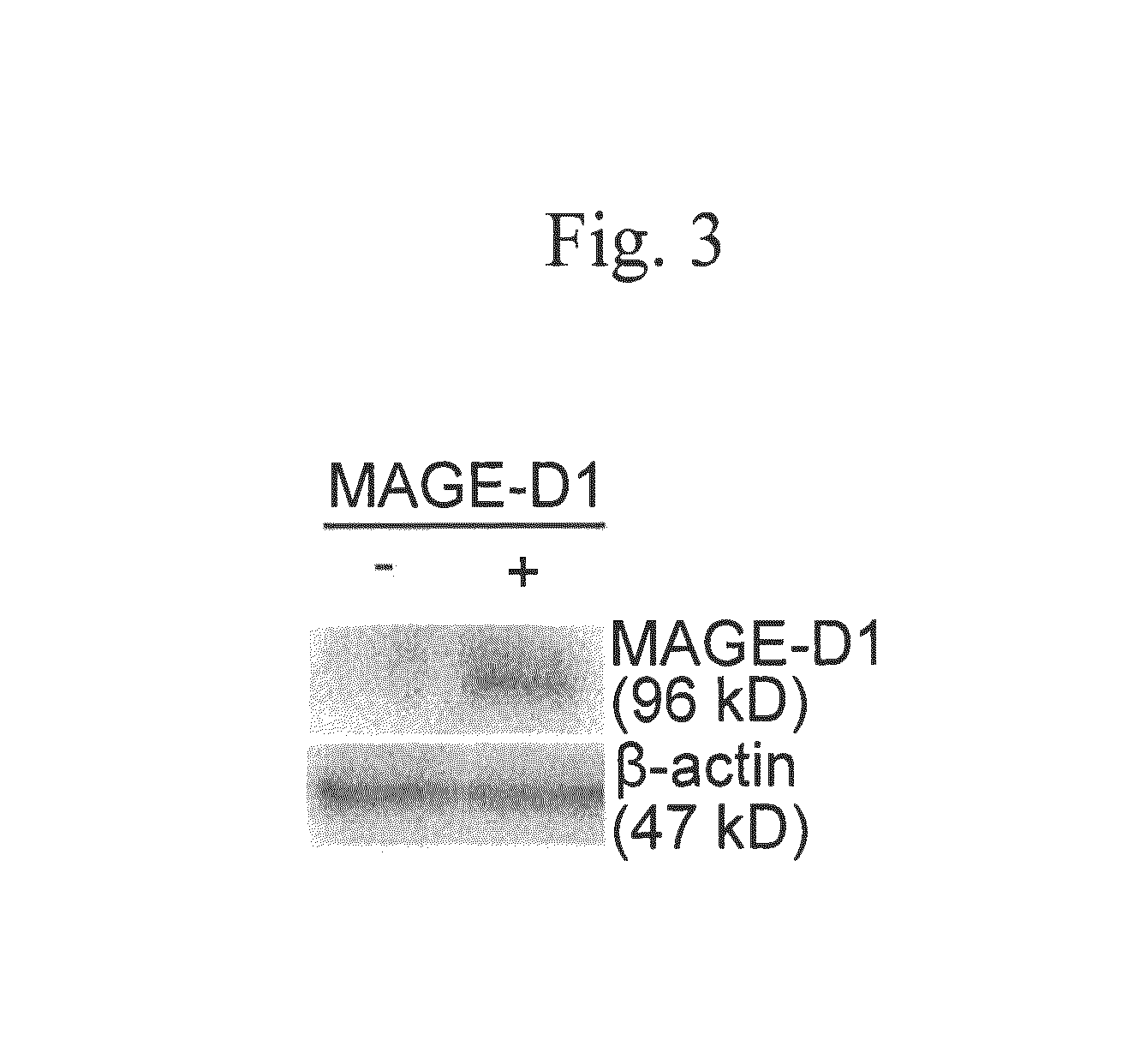 Method for determining depression, kit for analyzing serotonin transporter, and kit for analyzing ubiquitinated serotonin transporter in blood