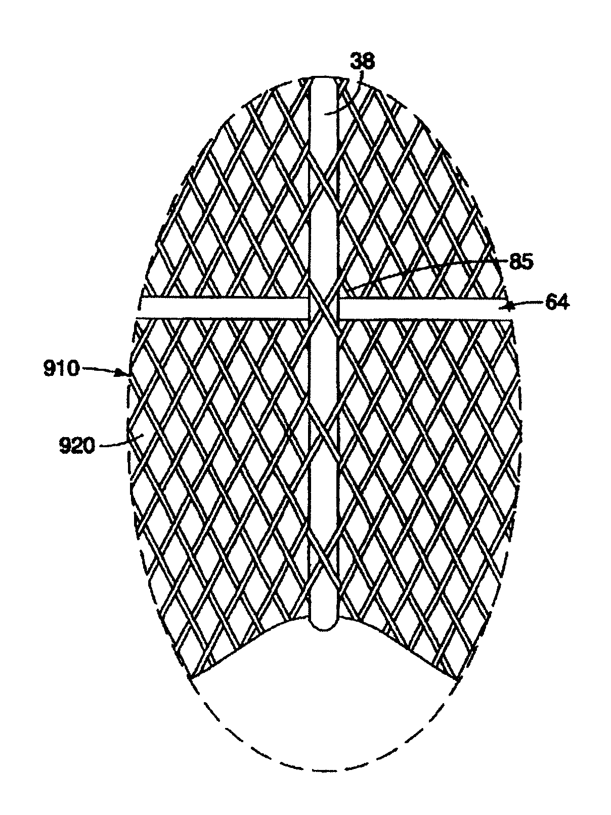 Method of delivering an intragastric device for treating obesity