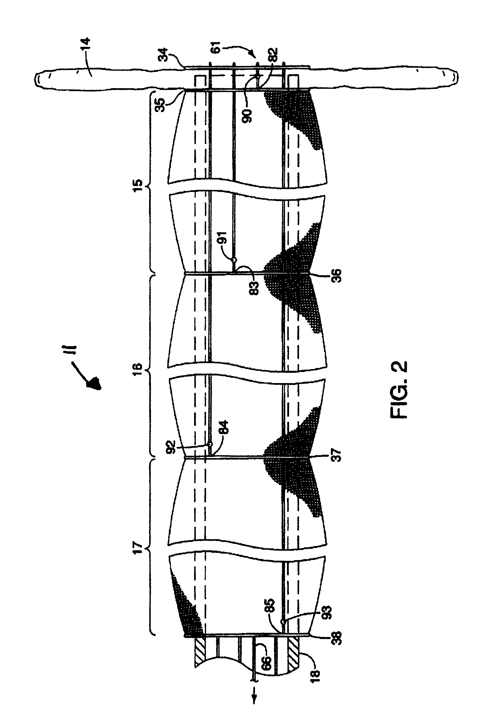 Method of delivering an intragastric device for treating obesity