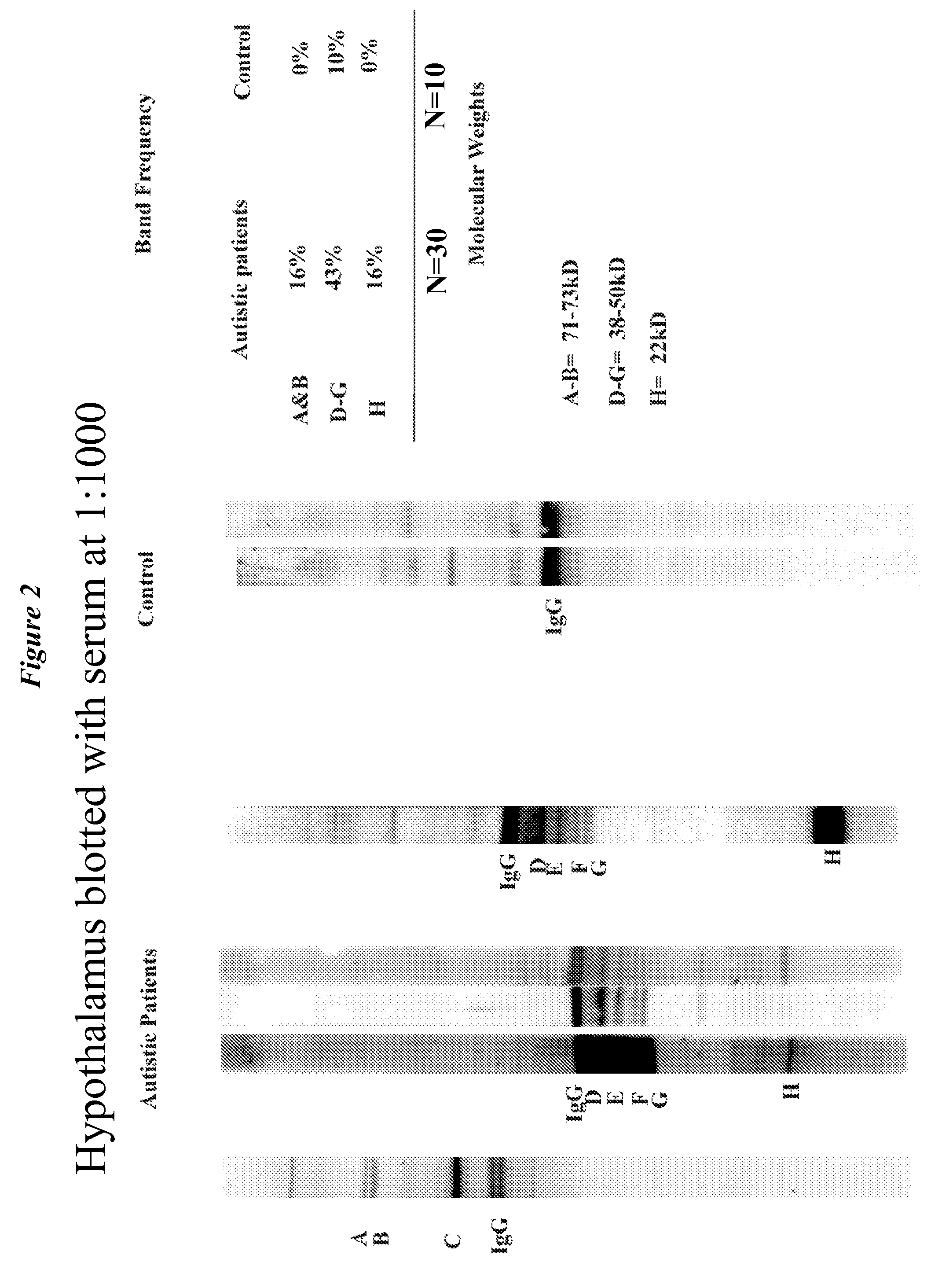 Diagnostic methods for the detection of risk of neurodevelopmental disorders