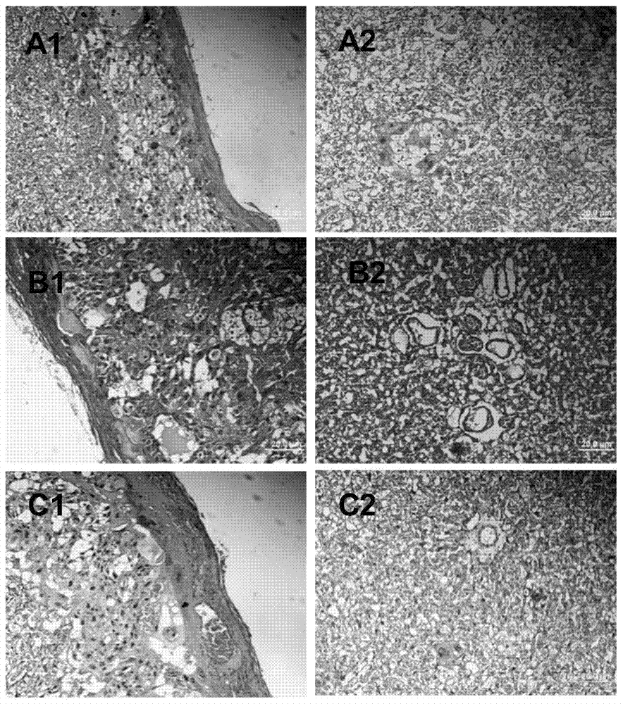 Application of astaxanthin in the preparation of products for the prevention or treatment of preeclampsia