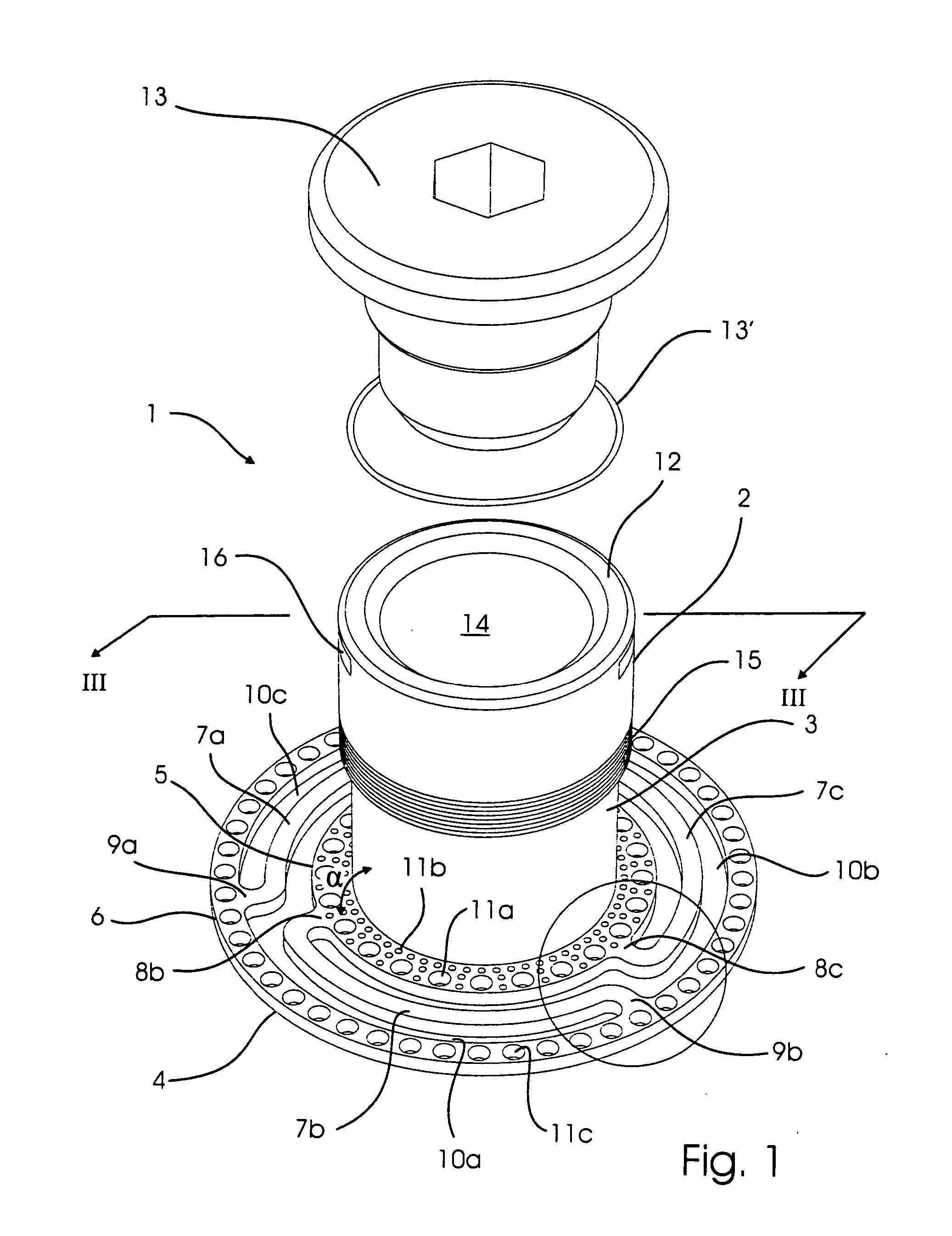 Implant