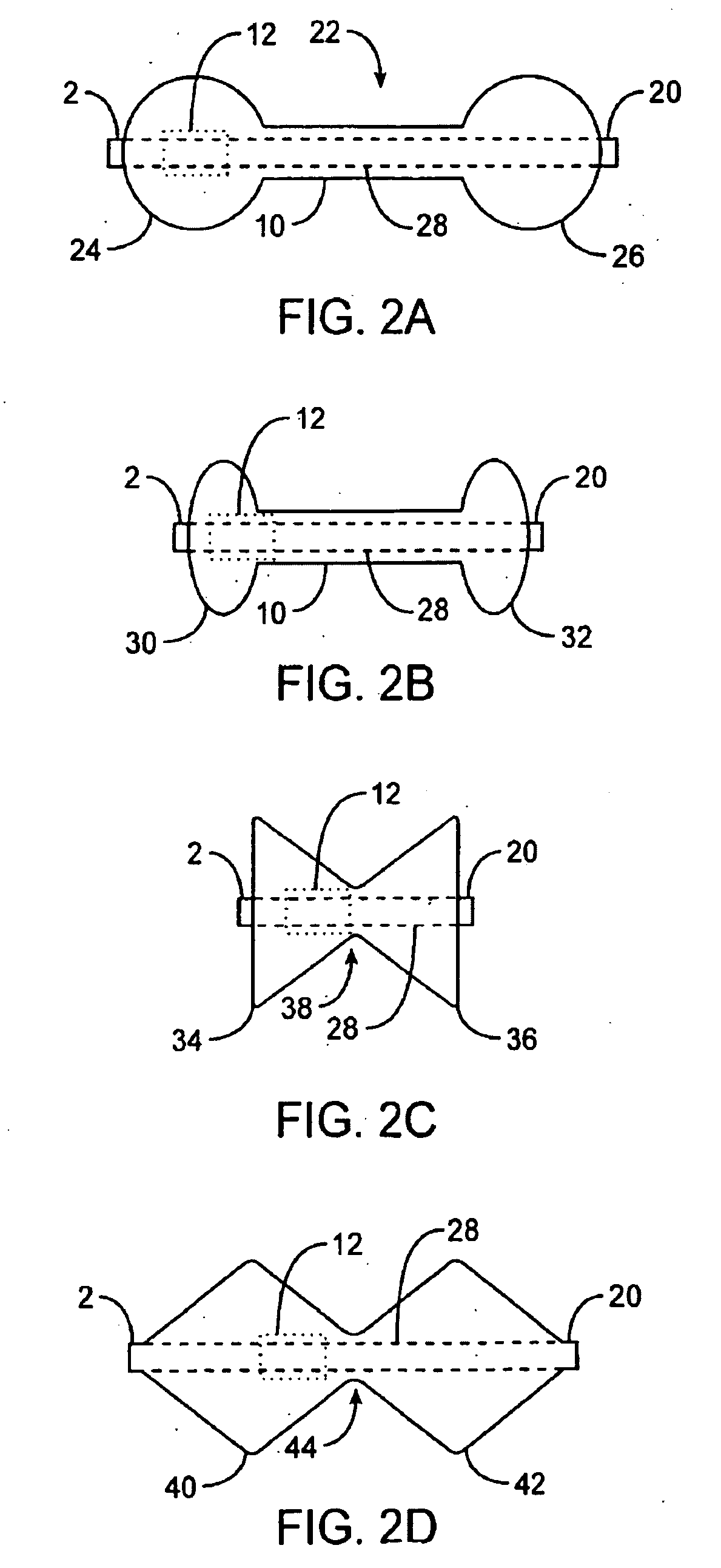 Pyloric valve obstructing devices and methods