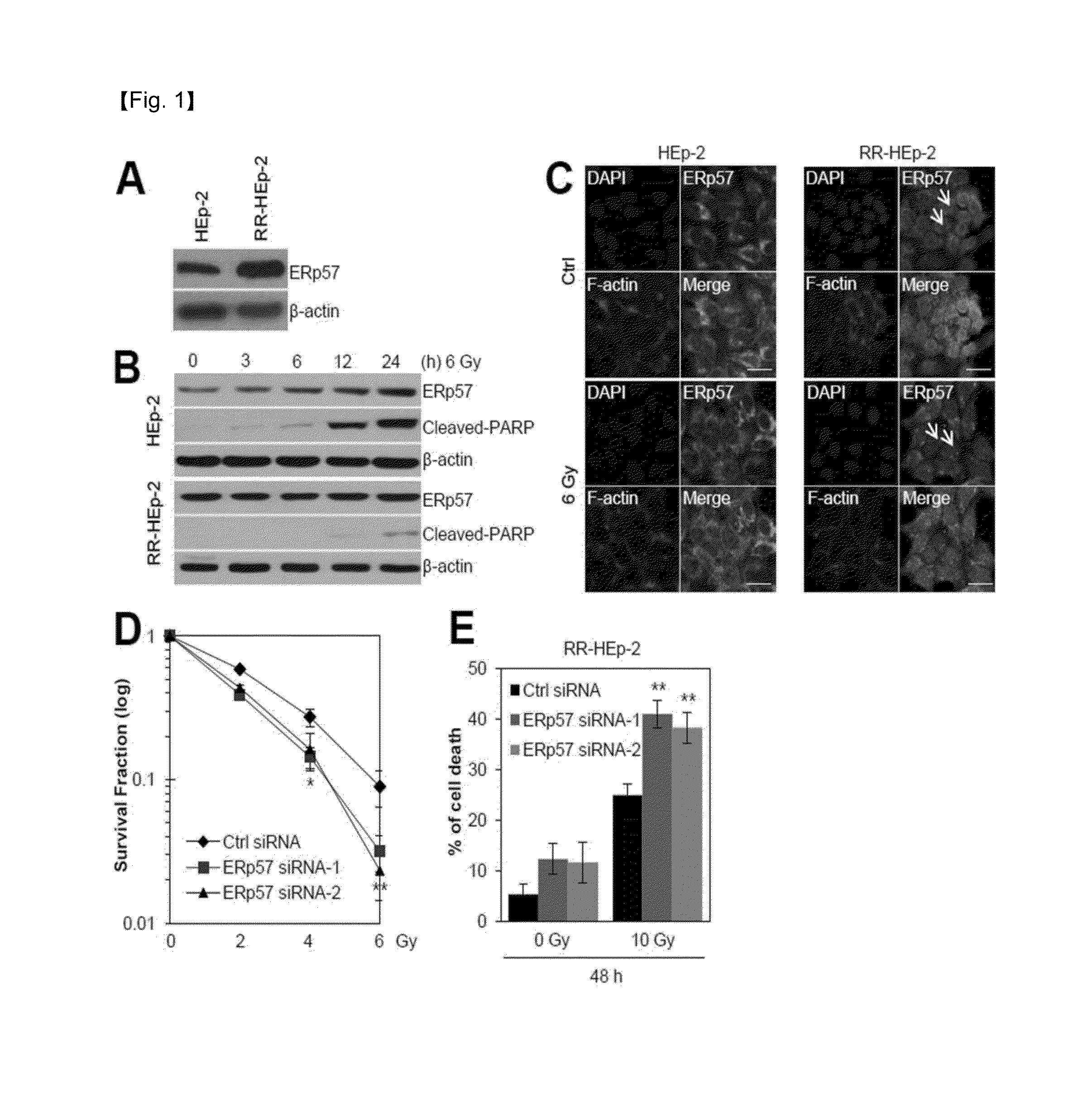 Method of diagnosing laryngeal cancer or diagnosing prognosis in radioresistance of laryngeal cancer