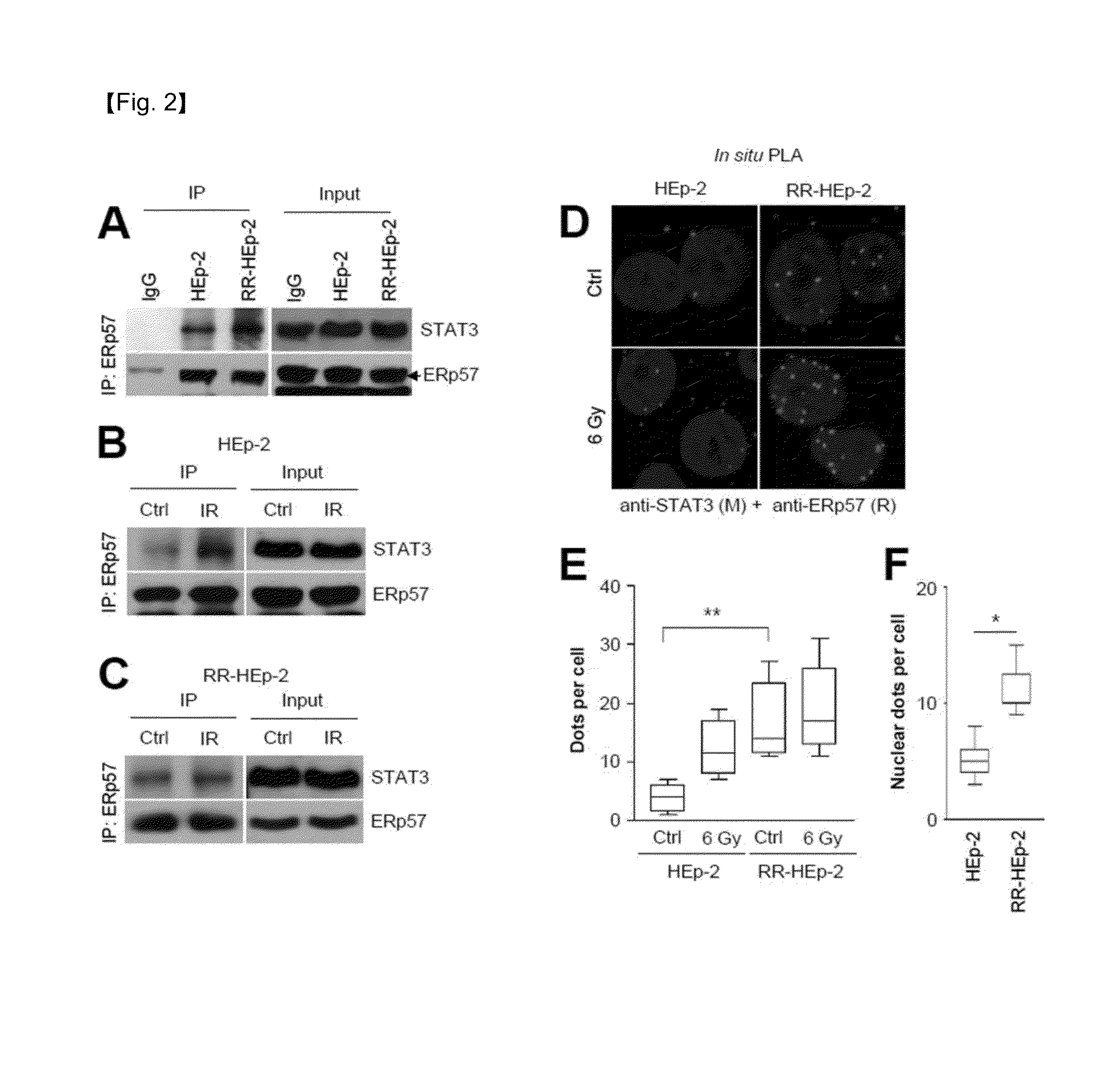 Method of diagnosing laryngeal cancer or diagnosing prognosis in radioresistance of laryngeal cancer