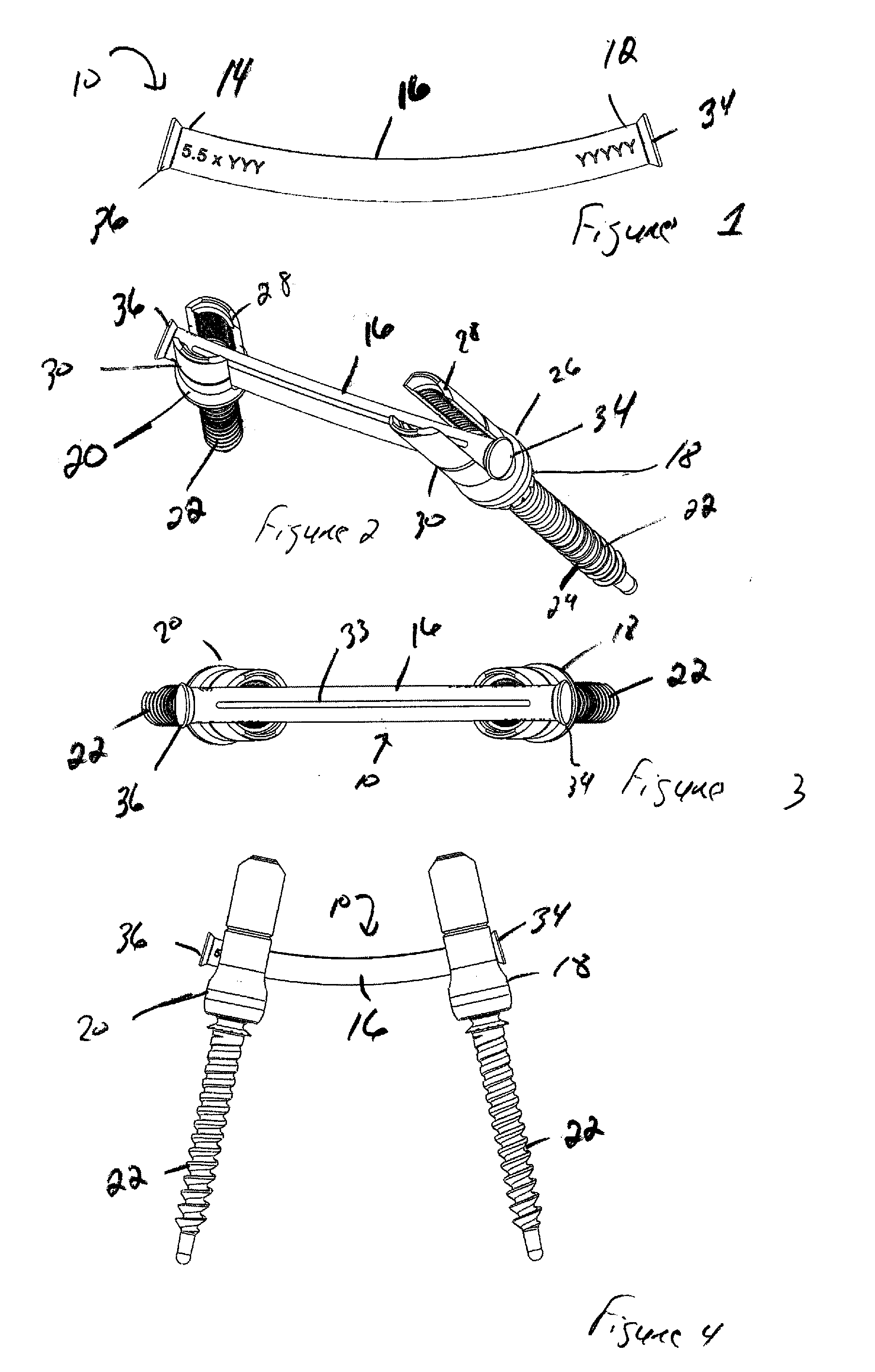 Minimally invasive spine surgery instruments: spinal rod with flange