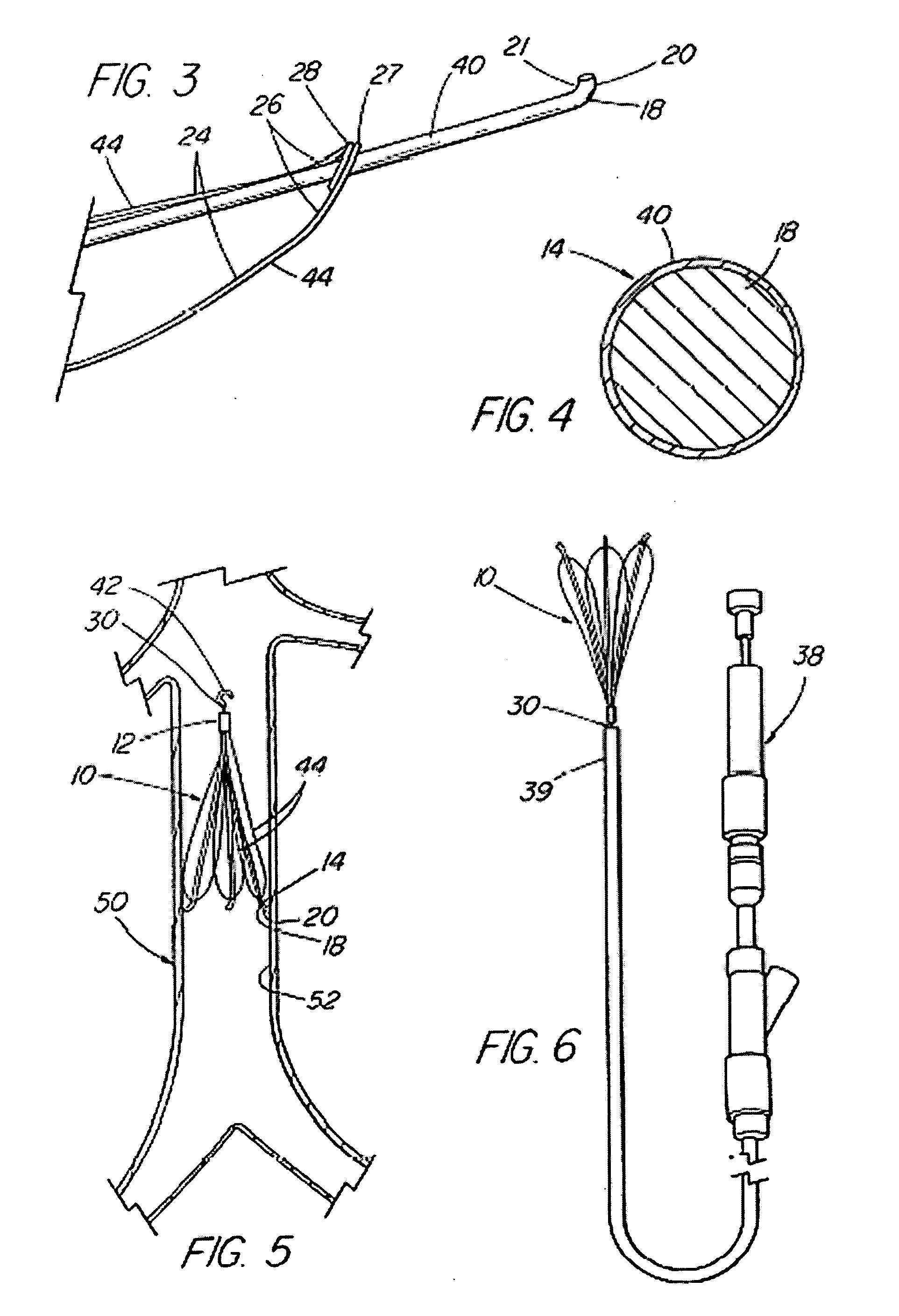 Endovascular filter