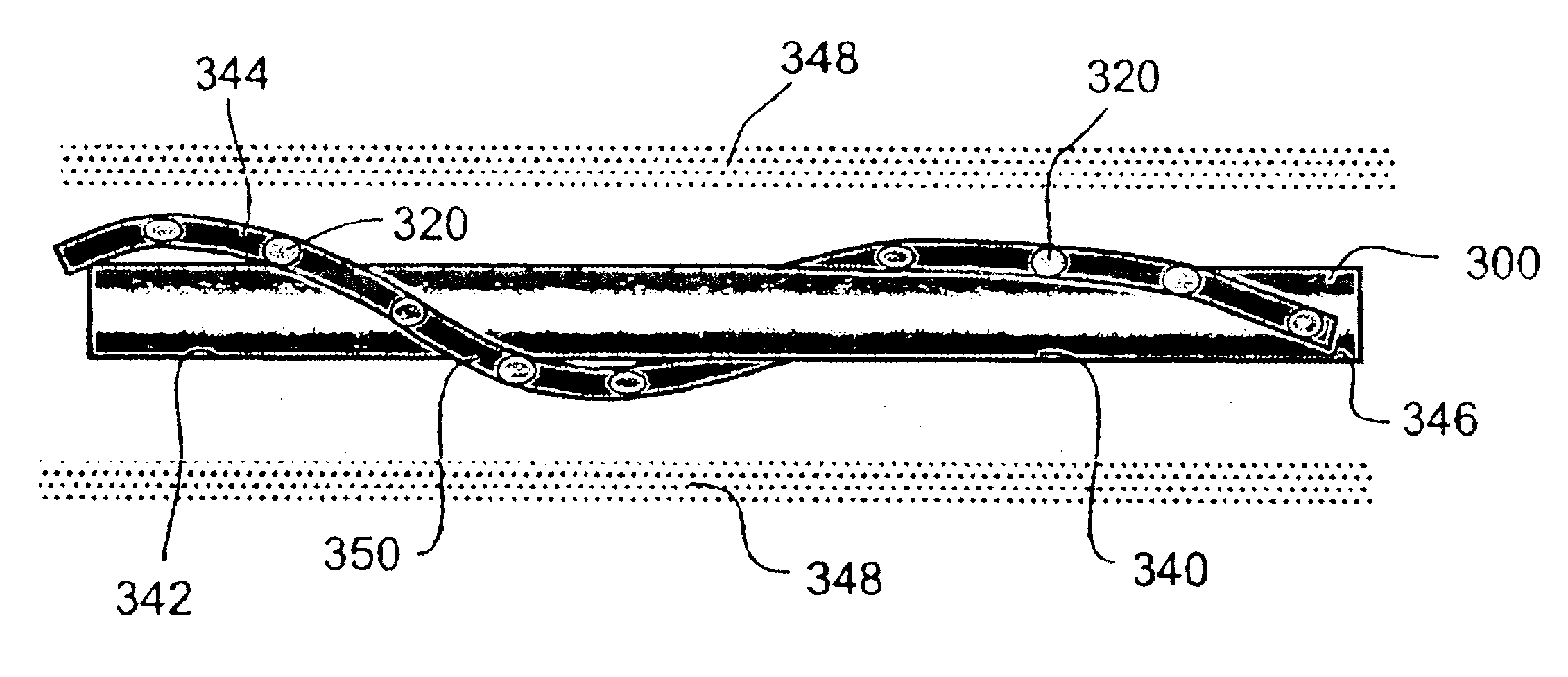 Cryoplasty apparatus and method