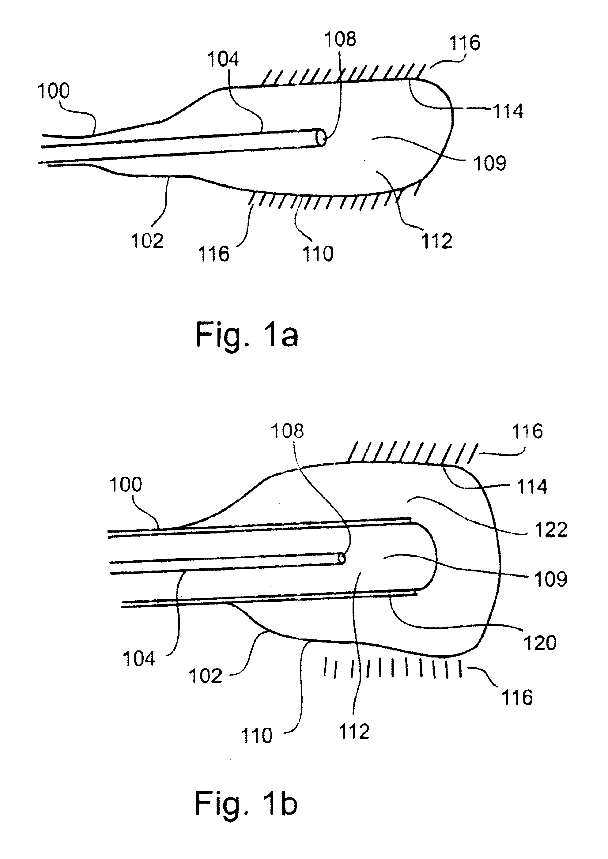 Cryoplasty apparatus and method