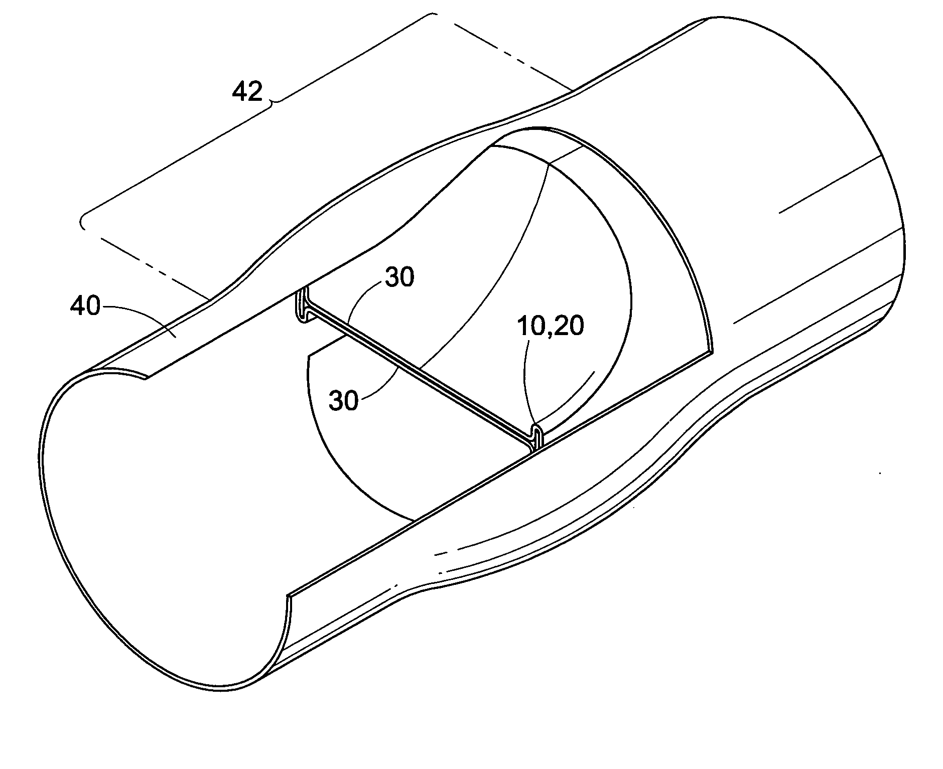 Implantable venous valve