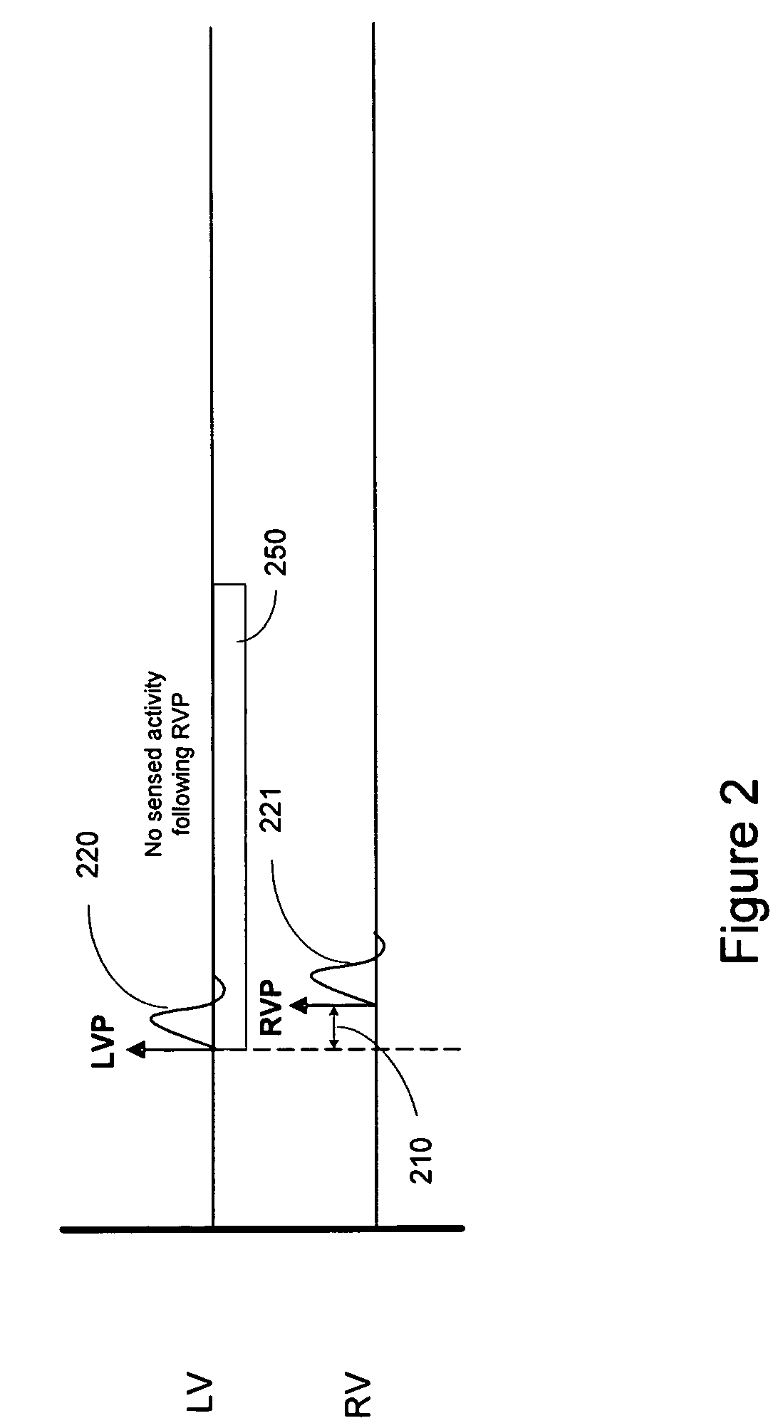 Capture detection based on propagated depolarization from a remote pacing site