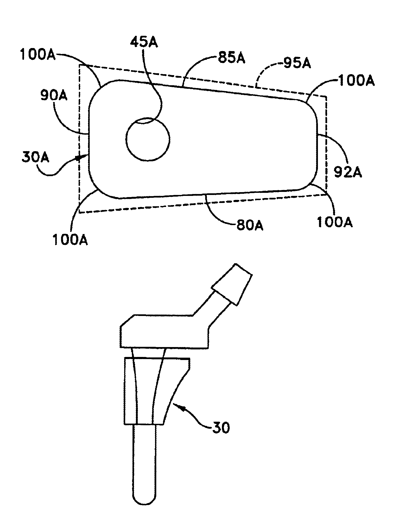 Modular prosthetic component with improved body shape