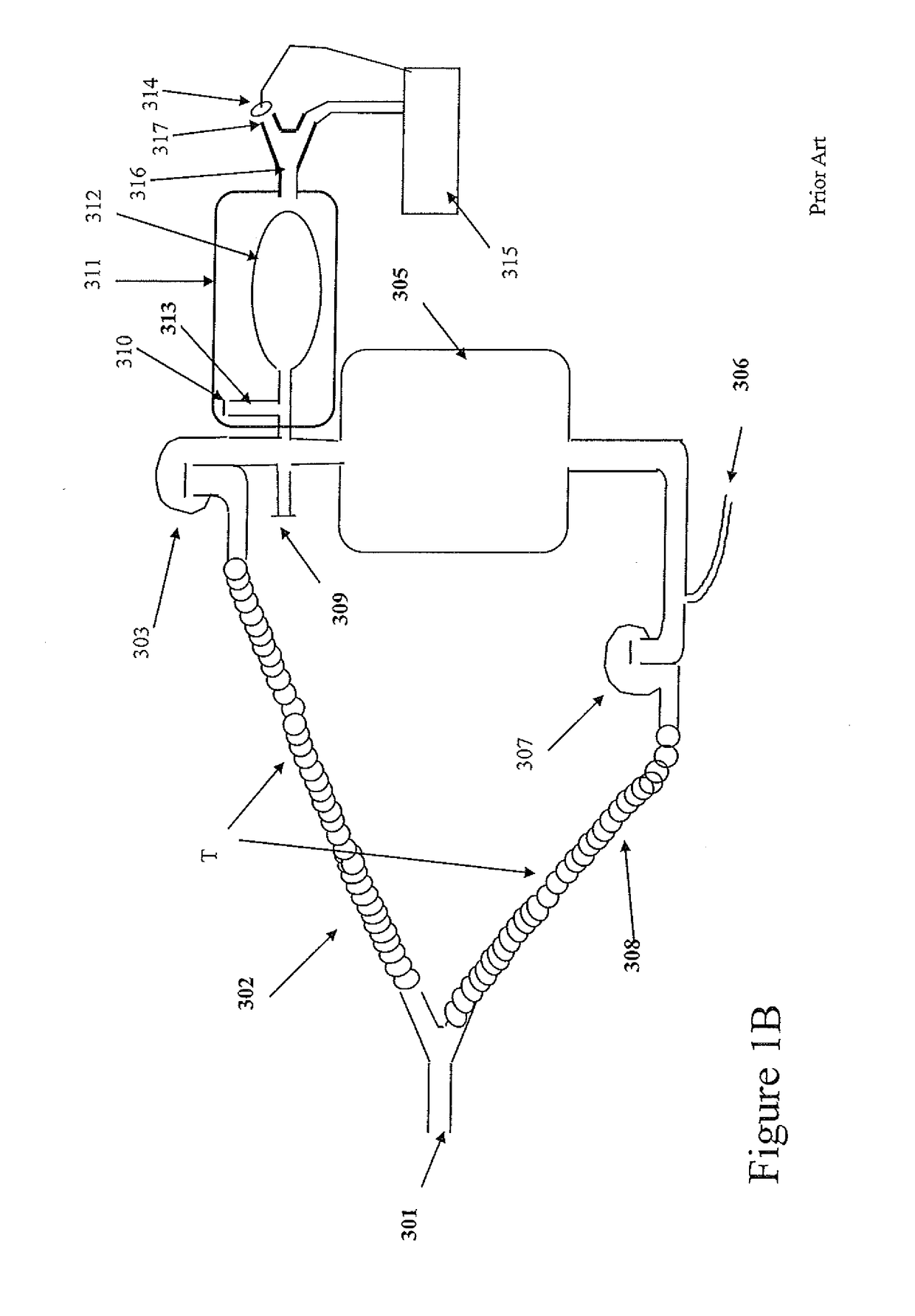 Breathing circuits to facilitate the measurement of cardiac output during controlled and spontaneous ventilation