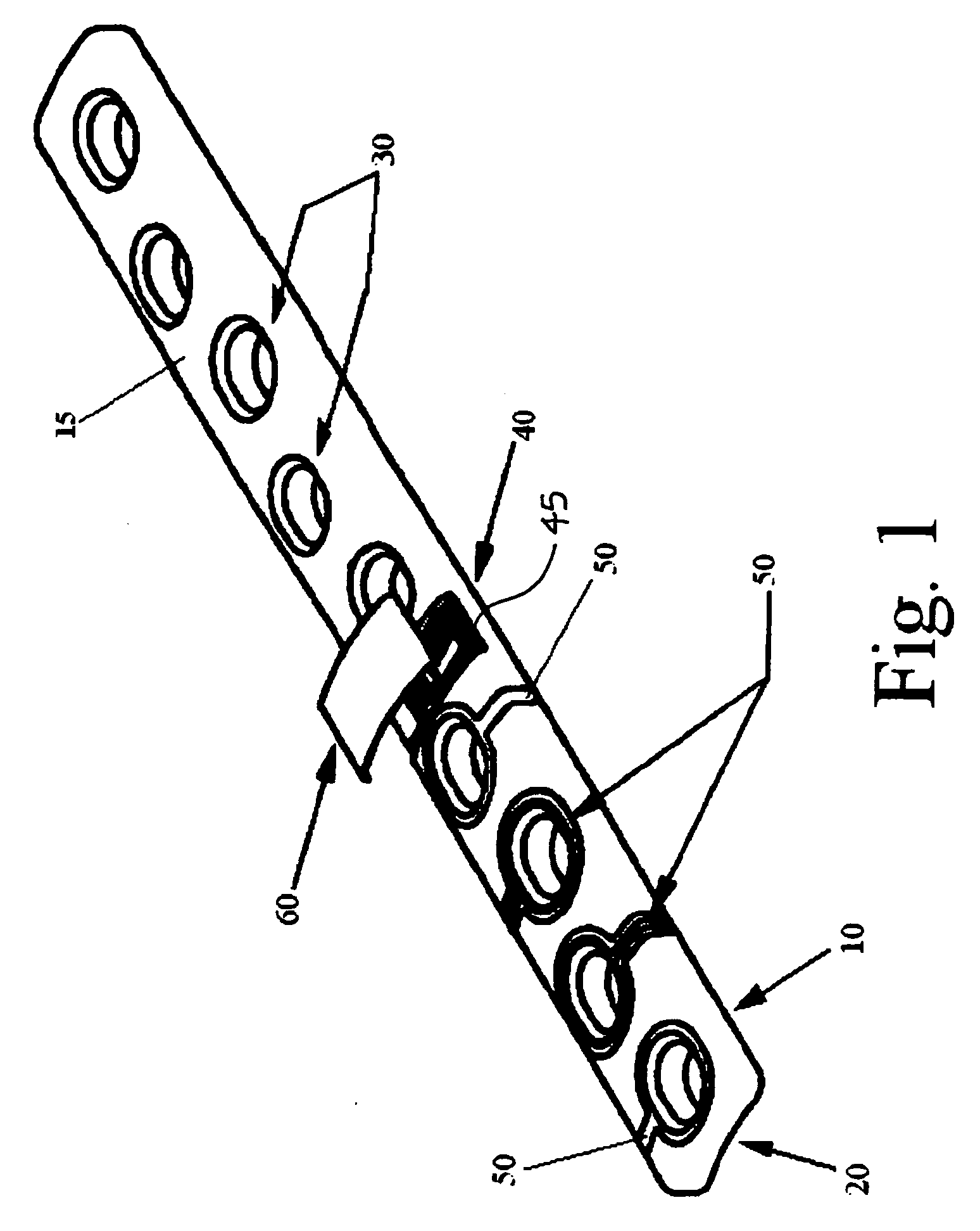 Orthopaedic implant with sensors