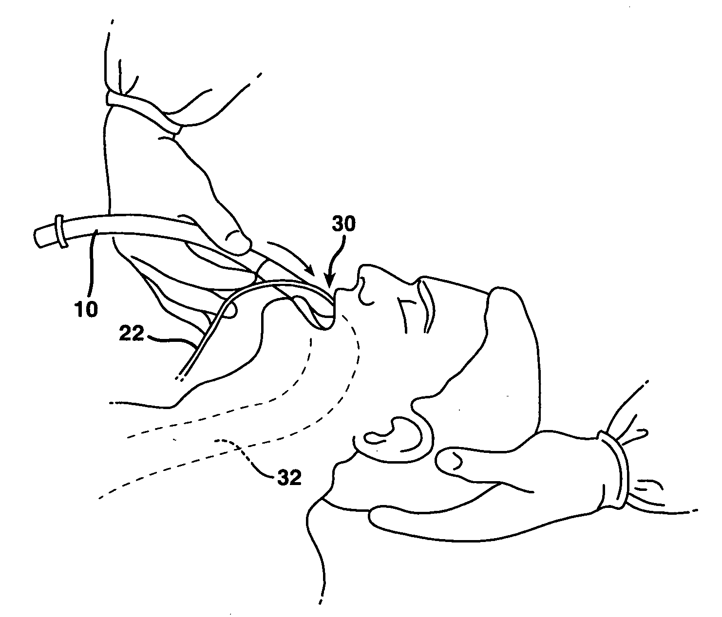 Composition for use with artificial airway devices