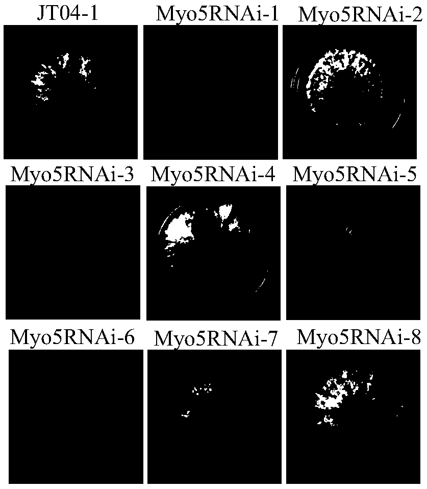 Myosin-5 and application of myosin-5 to cyanoacrylate drug resistance treatment