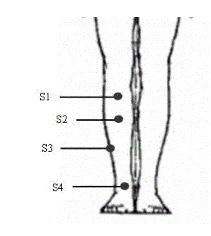 Method for forecasting clothing pressure distribution of human shanks