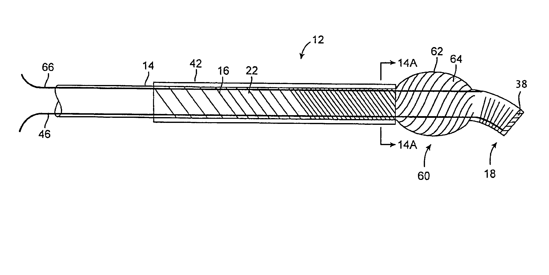 Steerable distal support system