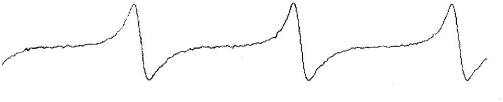 Timing signal fault diagnosis device for electronic control internal combustion engine