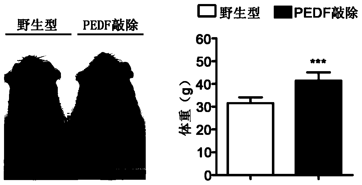 Application of pedf gene in the treatment of diabetic myocardial injury