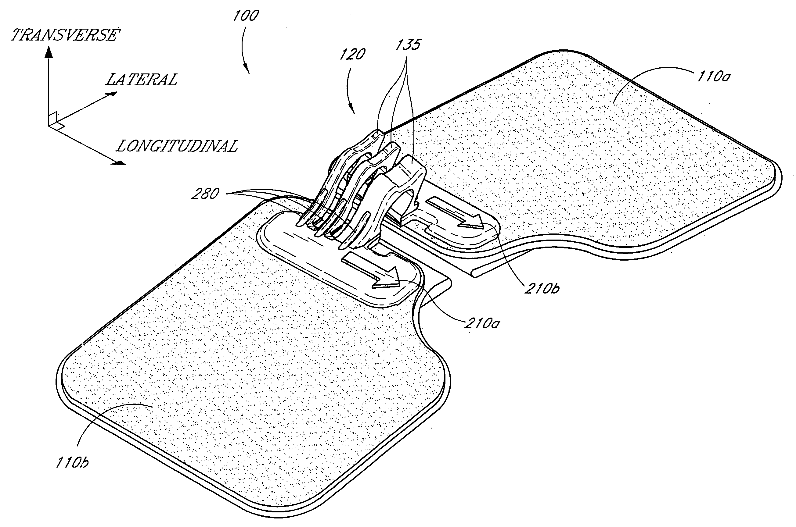 Catheter securement device