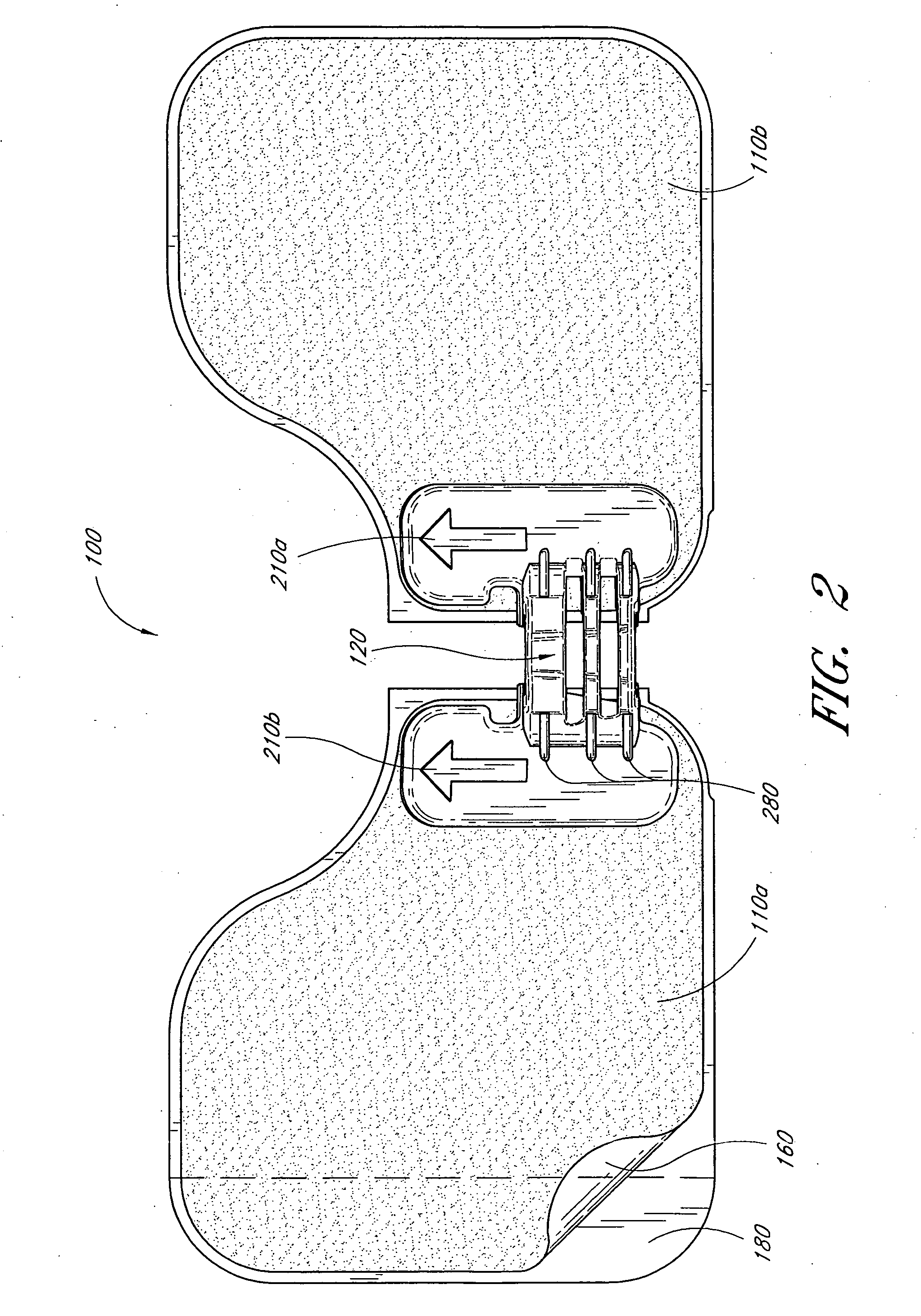 Catheter securement device