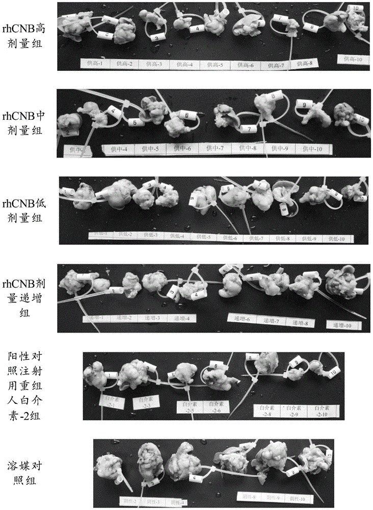 Application of recombinant human calcineurin subunit b