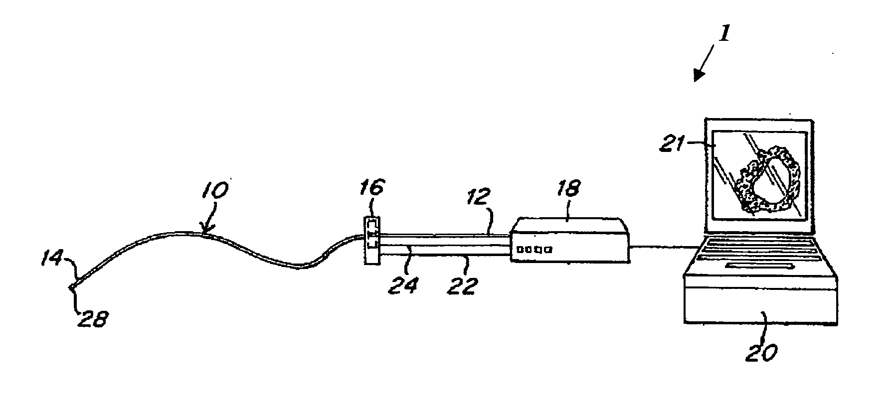 System and method for reducing angular geometric distortion in an imaging device