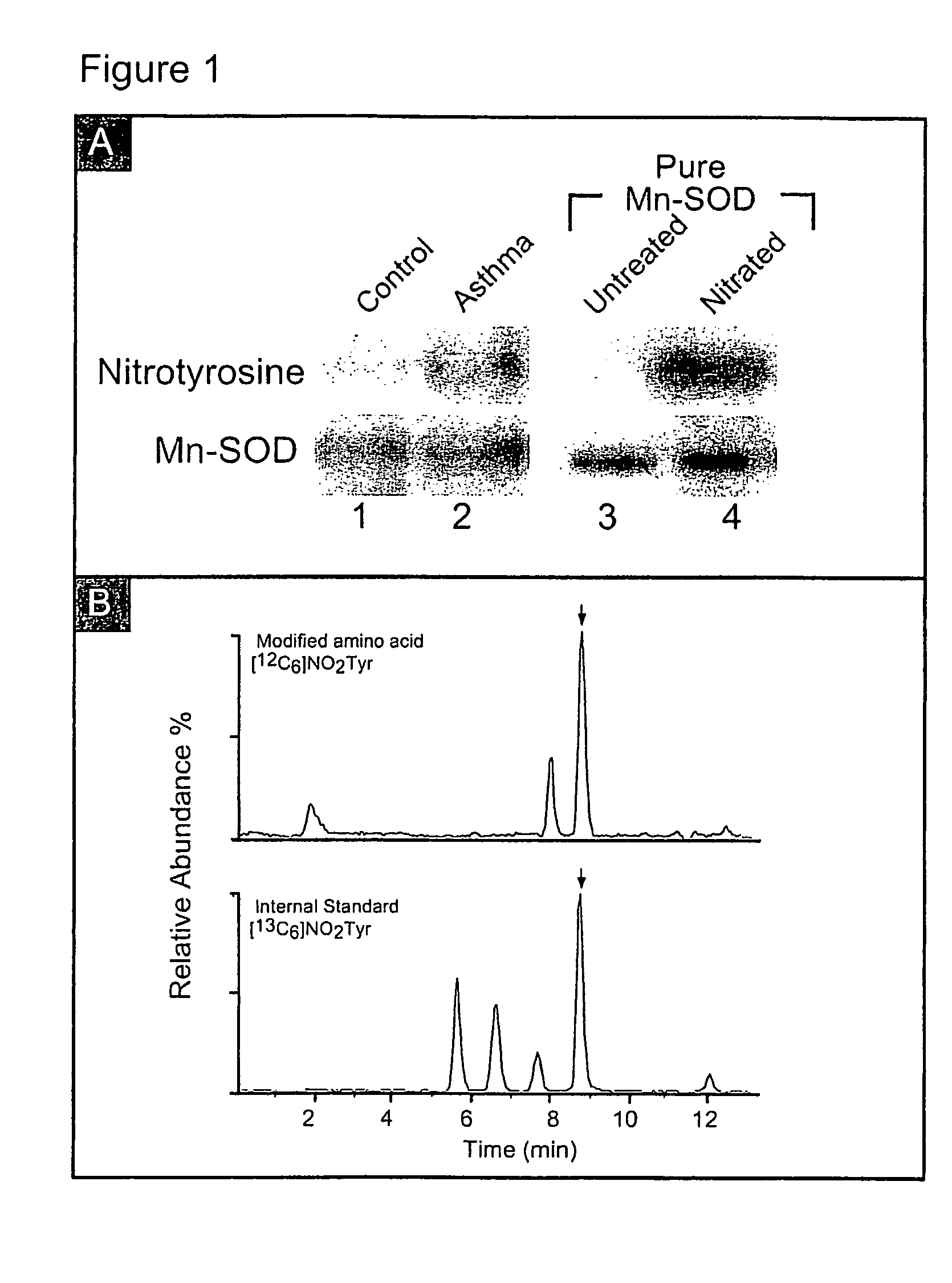 Systemic markers for asthma and analogous diseases