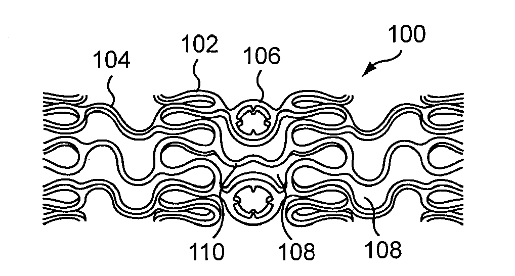 Stents and Stent Grafts