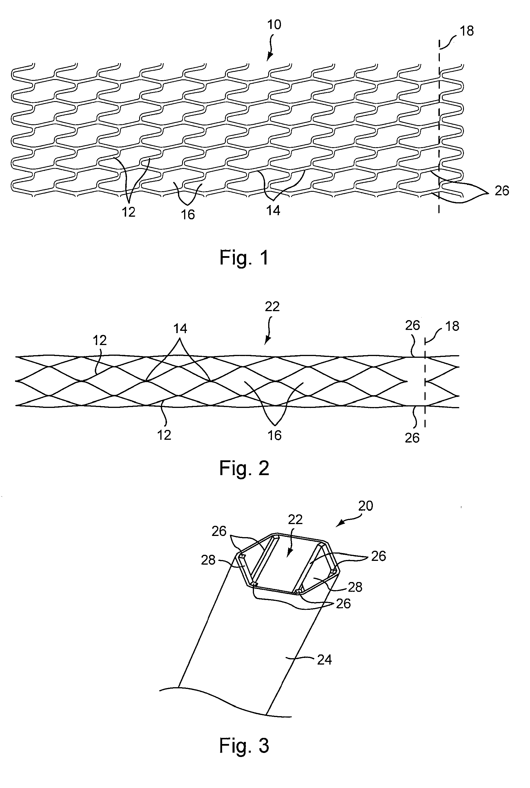 Stents and Stent Grafts