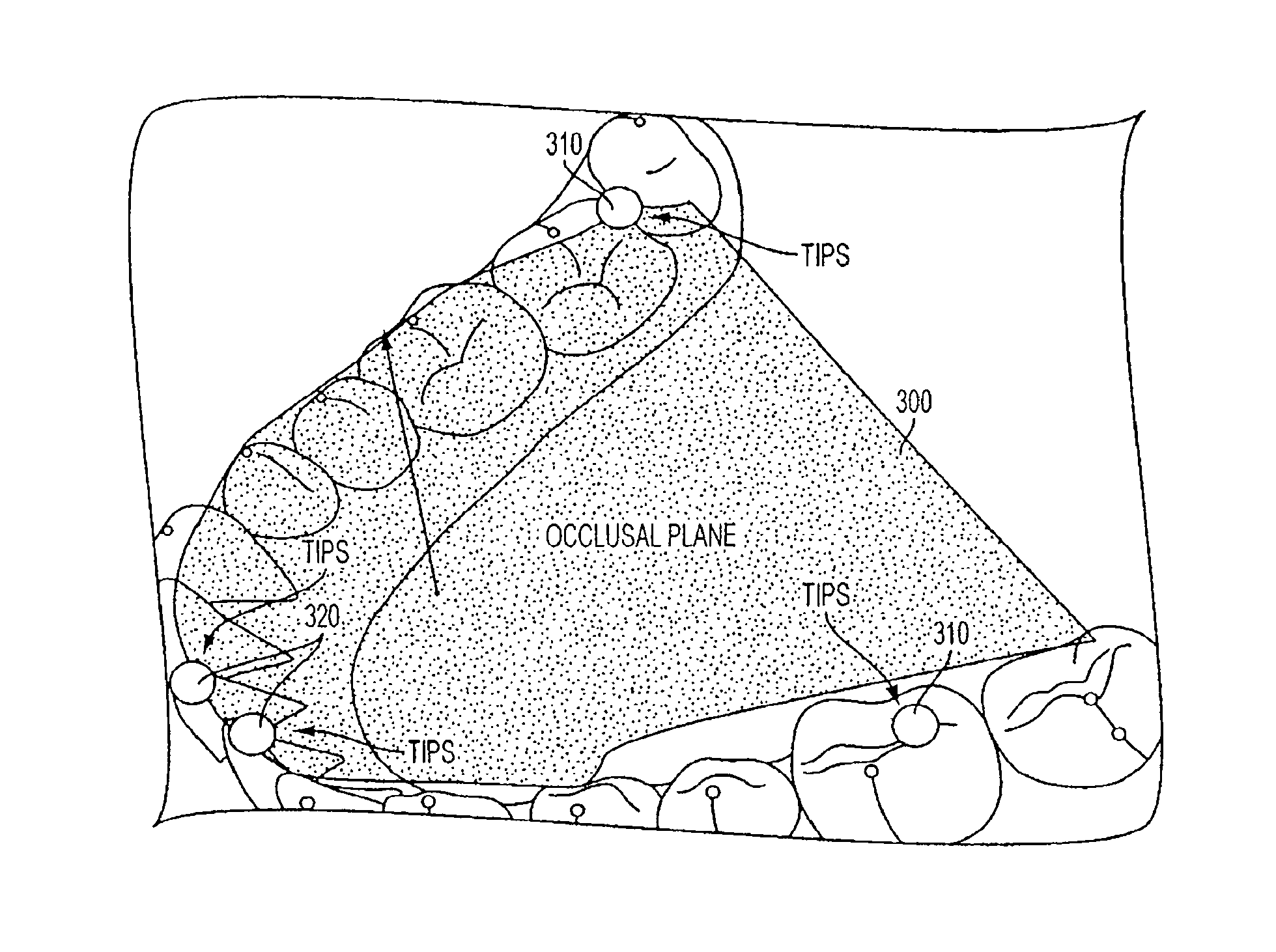 System and method for automatic construction of orthodontic reference objects