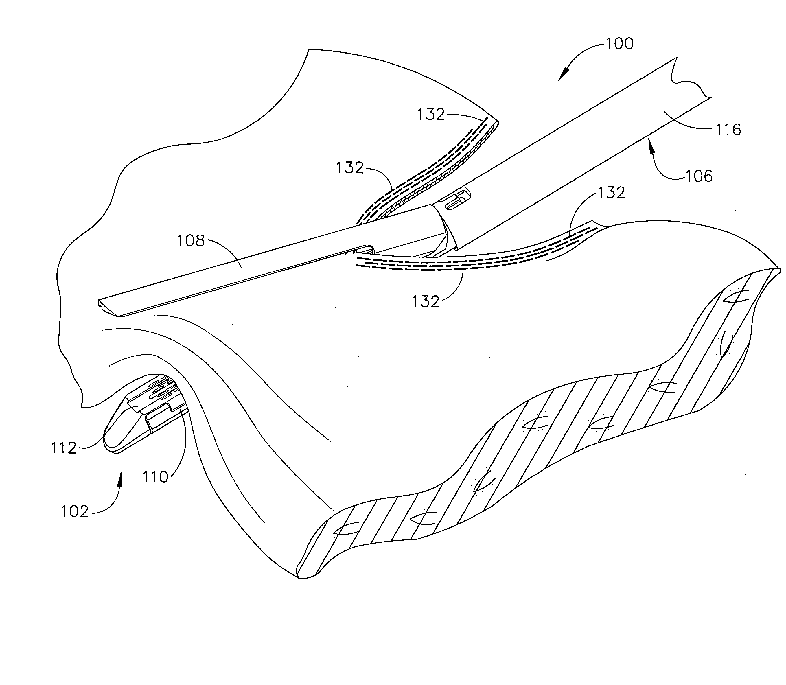 Apparatus for closing a curved anvil of a surgical stapling device