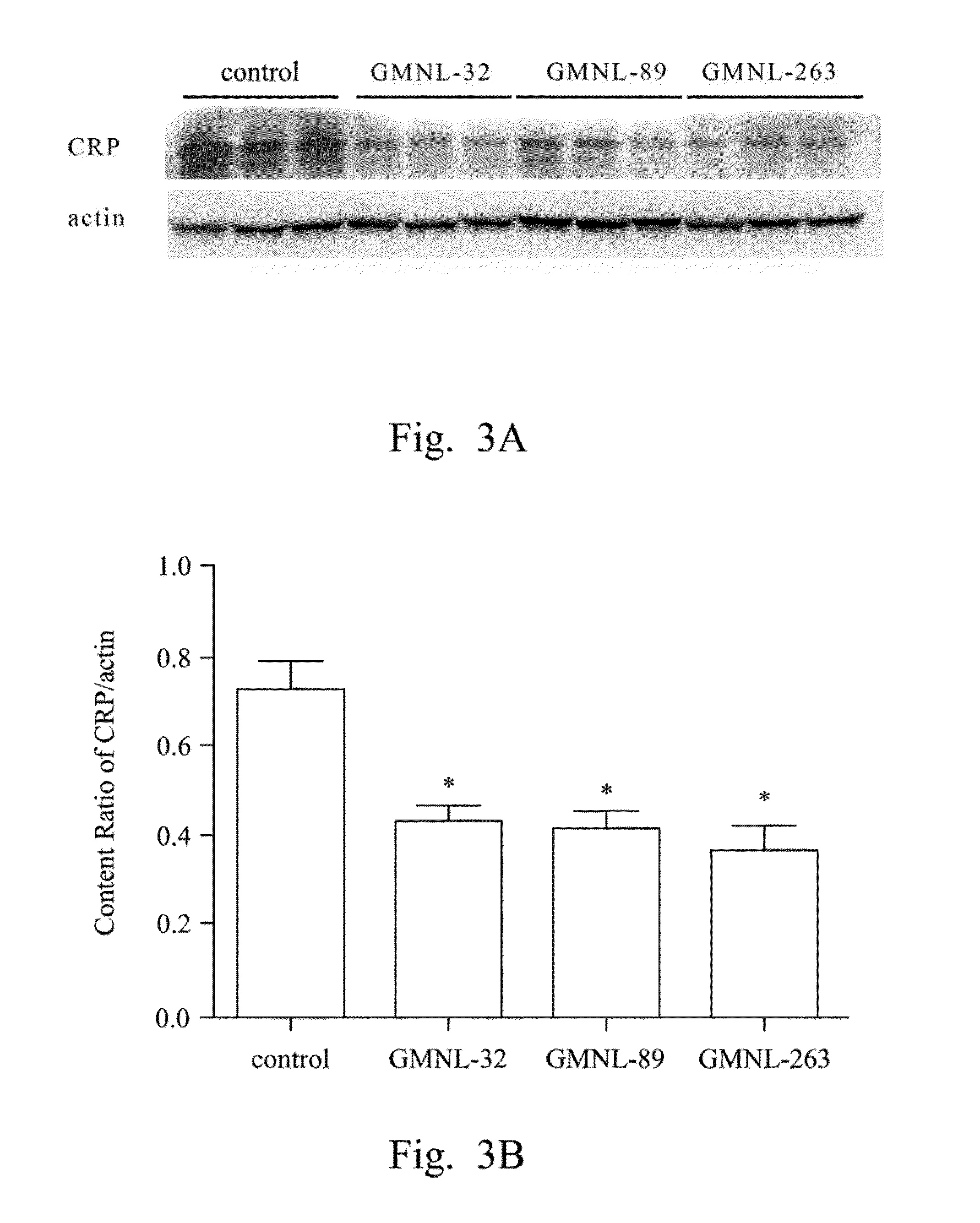 Lactobacillus strain, composition and use thereof for treating syndromes and related complications of autoimmune diseases