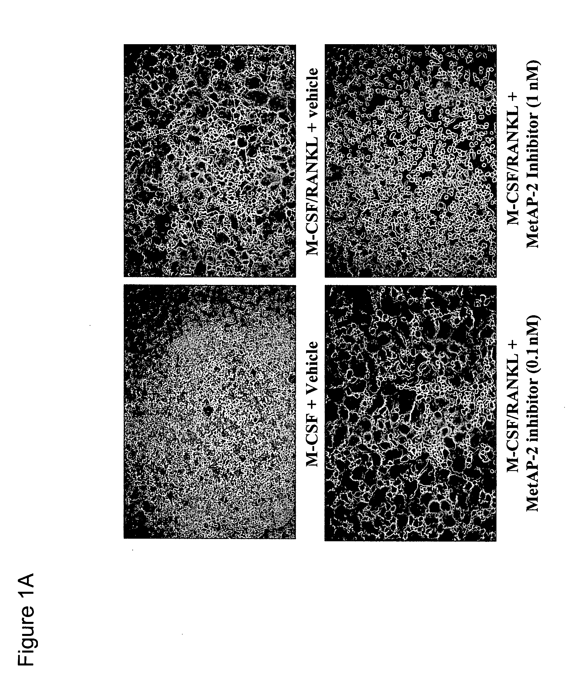 Methods for treating bone associated diseases by the use of methionine aminopeptidase-2 inhibitors