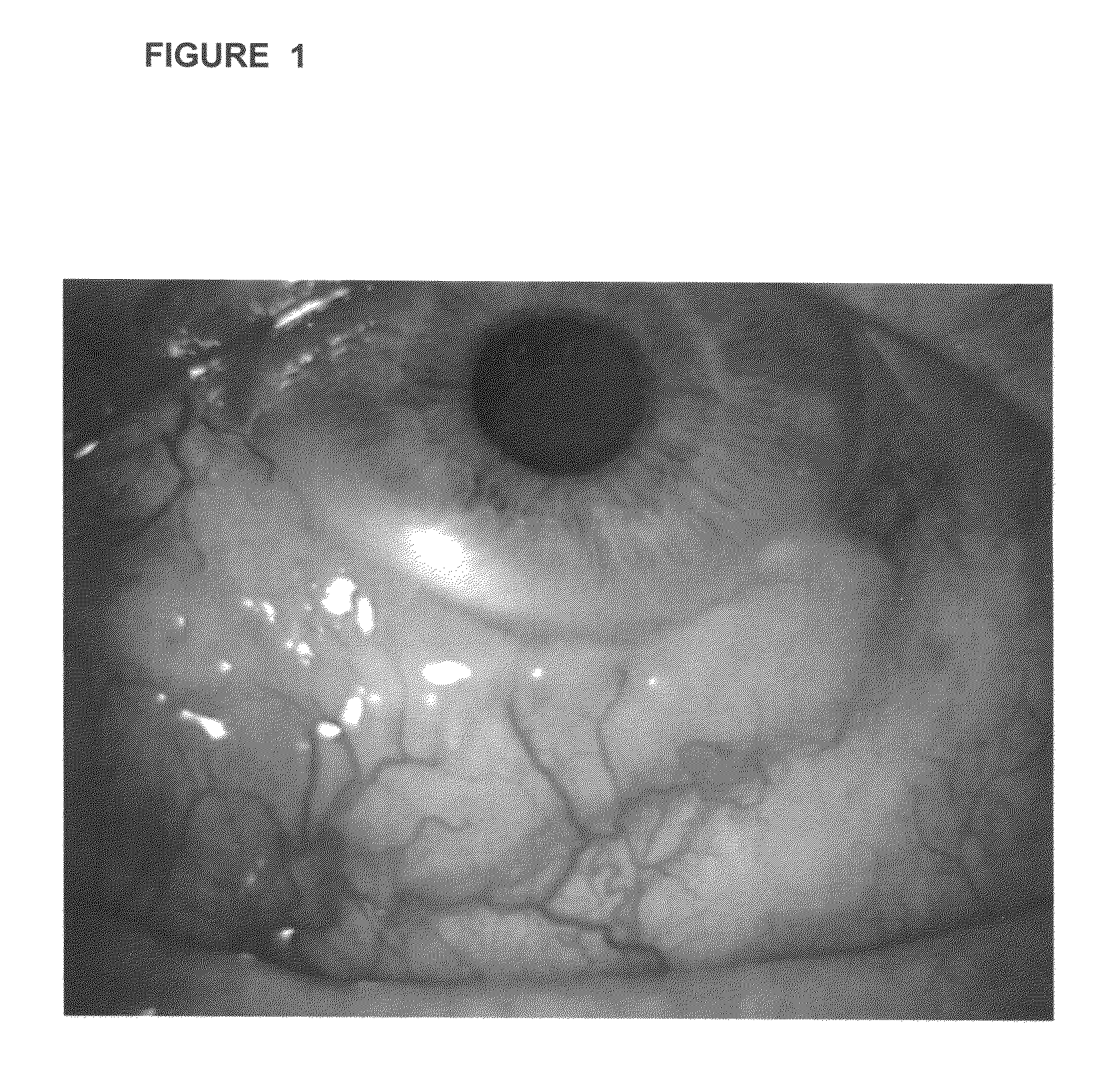 Treatment of ocular lesions