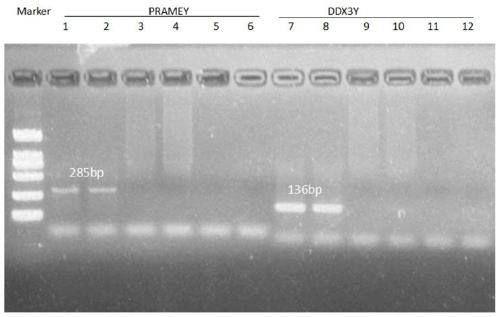 Method for detecting sheep PRAMEY gene copy number variation and application thereof