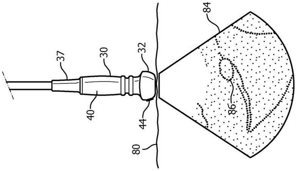 Ultrasound guidance of needle path during biopsy