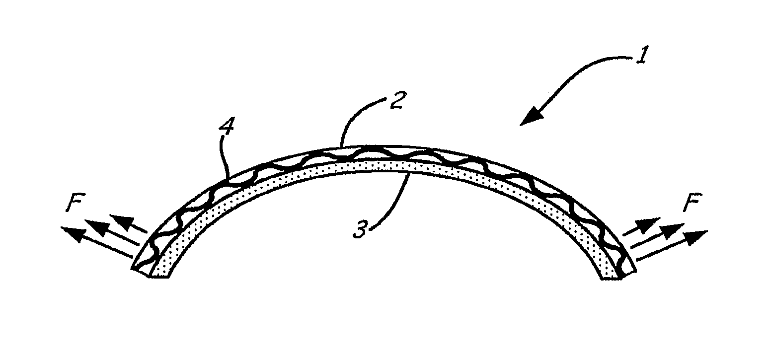 Delayed Action Spring Force Element for Nasal Dilators