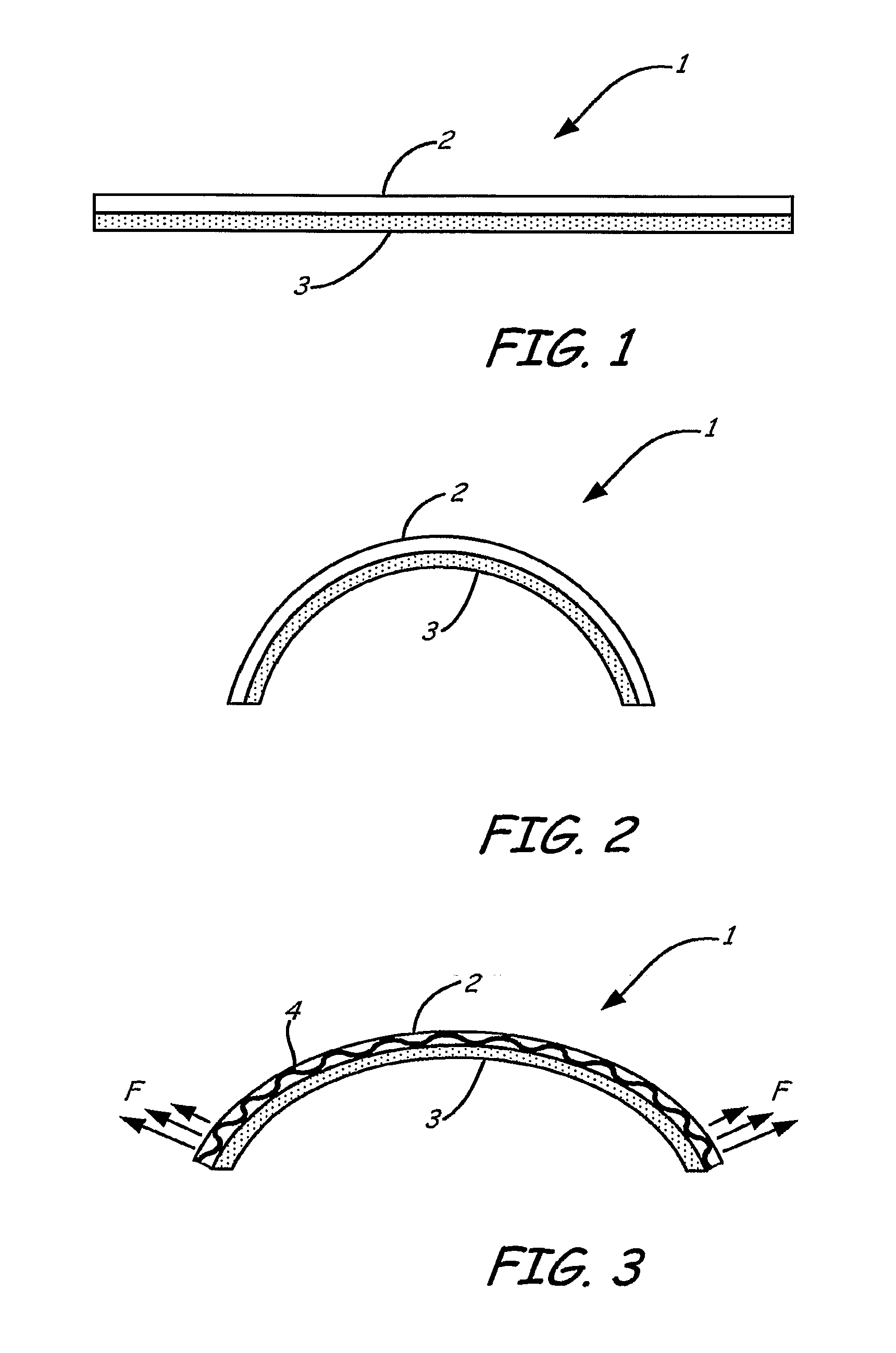 Delayed Action Spring Force Element for Nasal Dilators