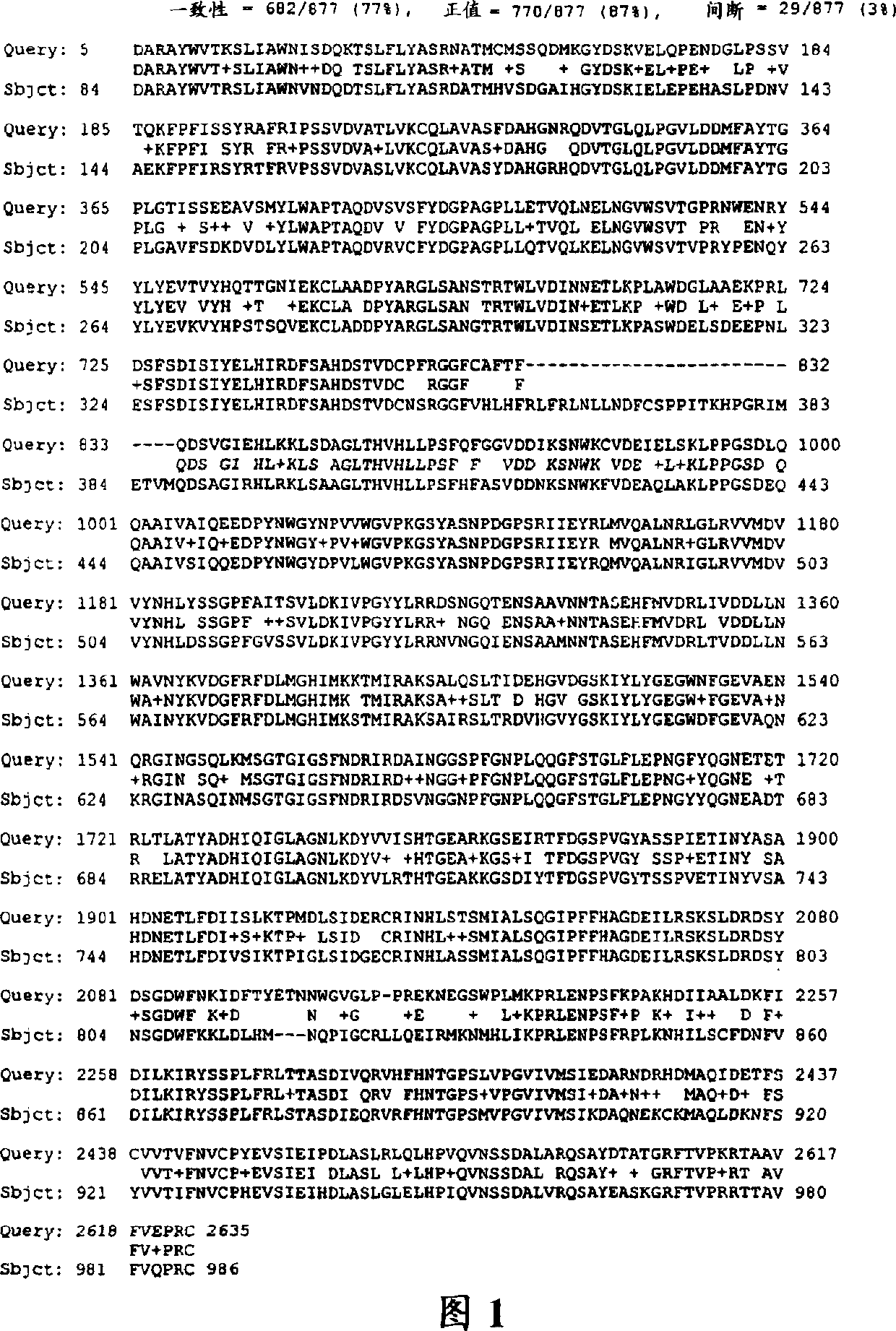 Corn pullulanase