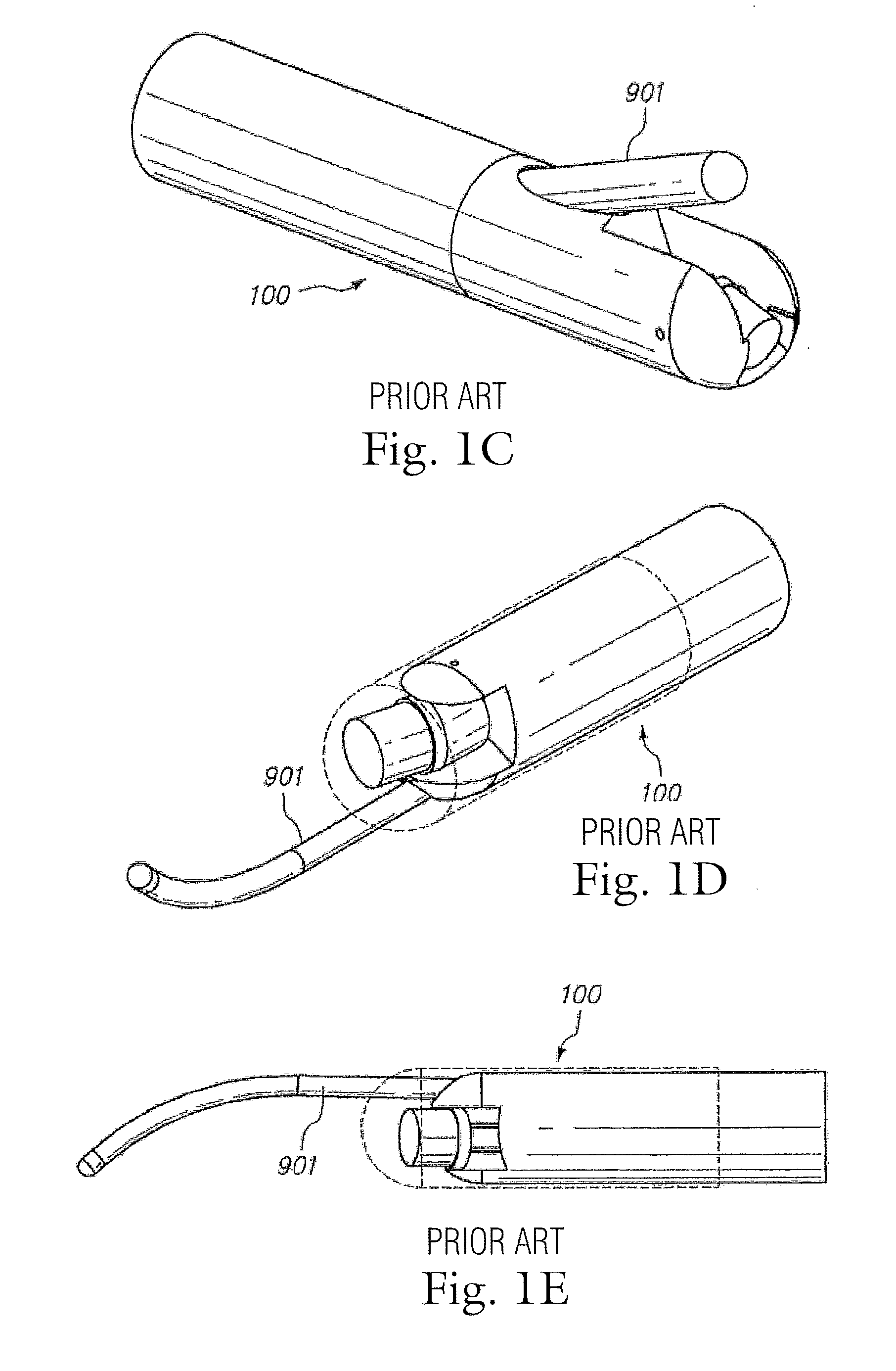 Delivery catheter with forward-looking ultrasoung imaging